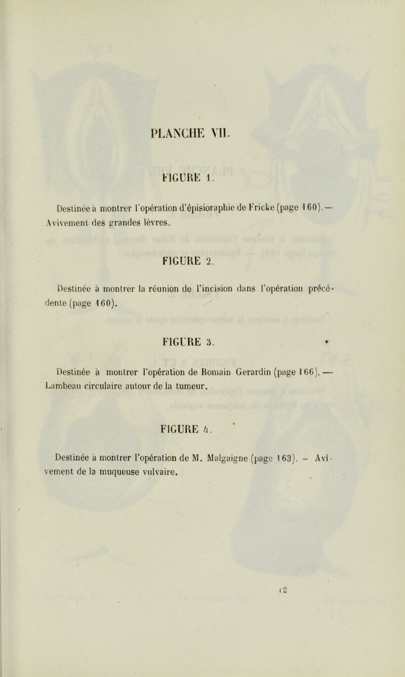 FIGURE 1. Destinée à montrer l'opération d’épisioraphie de Fricke (page 160). — Avivement des grandes lèvres. FIGURE 2. Destinée à montrer la réunion de l’incision dans l’opération précé- dente (page \ 60). FIGURE 3. Destinée à montrer l’opération de Romain Gerardin (page I 66).— Lambeau circulaire autour de ia tumeur. FIGURE U. Destinée a montrer l’opération de M. Malgaigne (page 163). - Avi- vement de la muqueuse vulvaire.