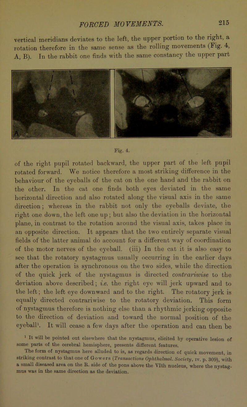 vertical meridians deviates to the left, the upper portion to the right, a rotation therefore in the same sense as the rolling movements (Fig. 4, A, B). In the rabbit one finds with the same constancy the upper part Fig. 4. of the right pupil rotated backward, the upper part of the left pupil rotated forward. We notice therefore a most striking difference in the behaviour of the eyeballs of the cat on the one hand and the rabbit on the other. In the cat one finds both eyes deviated in the same horizontal direction and also rotated along the visual axis in the same direction; whereas in the rabbit not only the eyeballs deviate, the right one down, the left one up ; but also the deviation in the horizontal plane, in contrast to the rotation around the visual axis, takes place in an opposite direction. It appears that the two entirety separate visual fields of the latter animal do account for a different way of coordination of the motor nerves of the eyeball, (iii) In the cat it is also easy to see that the rotatory nystagmus usually occurring in the earlier days after the operation is synchronous on the two sides, while the direction of the quick jerk of the nystagmus is directed contrariivise to the deviation above described; i.e. the right eye will jerk upward and to the left; the left eye downward and to the right. The rotatory jerk is equally directed contrariwise to the rotatory deviation. This form of nystagmus therefore is nothing else than a rhythmic jerking opposite to the direction of deviation and toward the normal position of the eyeball1. It will cease a few days after the operation and can then be 1 It will be pointed out elsewhere that the nystagmus, elicited by operative lesion of some parts of the cerebral hemisphere, presents different features. The form of nystagmus here alluded to is, as regards direction of quick movement, in striking contrast to that one of Gowers (Transactions Ophthalmol. Society, iv. p. 309), with a small diseased area on the It. side of the pons above the Vlth nucleus, where the nystag- mus was in the same direction as the deviation.