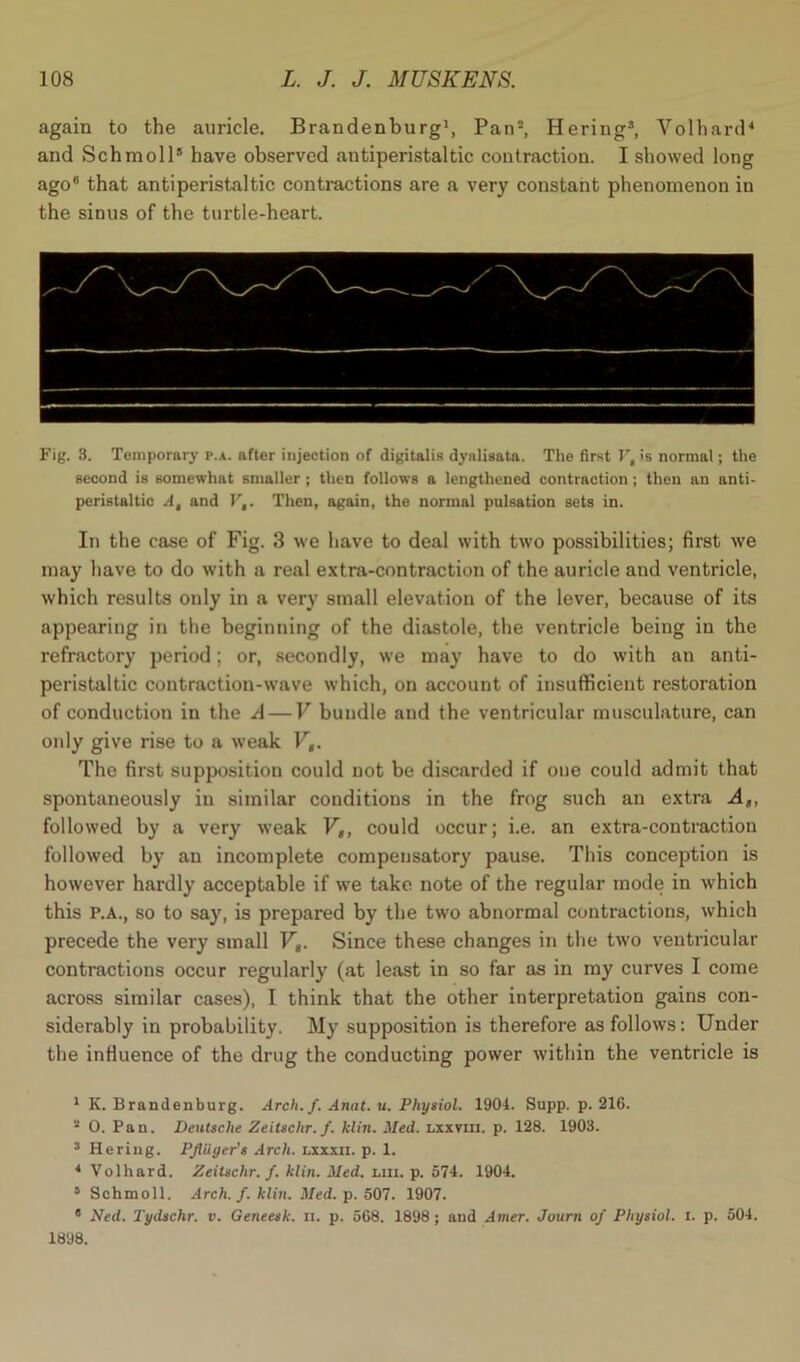 again to the auricle. Brandenburg1, Pan2, Hering3, Volhard4 5 and Schmoll6 have observed antiperistaltic contraction. I showed long ago6 that antiperistaltic contractions are a very constant phenomenon in the sinus of the turtle-heart. Fig. 3. Temporary p.a. after injection of digitalis dyalisata. The first V, >s normal; the second is somewhat smaller; then follows a lengthened contraction; then an anti- peristaltic A, and V,. Then, again, the normal pulsation sets in. In the case of Fig. 3 we have to deal with two possibilities; first we may have to do with a real extra-contraction of the auricle and ventricle, which results only in a very small elevation of the lever, because of its appearing in the beginning of the diastole, the ventricle being in the refractory period; or, secondly, we may have to do with an anti- peristaltic contraction-wave which, on account of insufficient restoration of conduction in the A — V bundle and the ventricular musculature, can only give rise to a weak V,. The first supposition could not be discarded if one could admit that spontaneously in similar conditions in the frog such an extra A„, followed by a very weak Vt) could occur; i.e. an extra-contraction followed by an incomplete compensatory pause. This conception is however hardly acceptable if we take note of the regular mode in which this P.A., so to say, is prepared by the two abnormal contractions, which precede the very small F„. Since these changes in the two ventricular contractions occur regularly (at least in so far as in my curves I come across similar cases), I think that the other interpretation gains con- siderably in probability. My supposition is therefore as follows: Under the influence of the drug the conducting power within the ventricle is 1 K. Brandenburg. Arch. f. Anat. u. Physiol. 1904. Supp. p. 216. 2 0. Pan. Deutsche Zeitschr. f. klin. Med. lxxviii. p. 128. 1903. 3 Hering. Pfiiiger’s Arch, lxxxii. p. 1. 4 Volhard. Zeitschr. f. klin. Med. im. p. 574. 1904. 5 Schmoll. Arch. f. klin. Med. p. 507. 1907. 6 Ned. Tydschr. v. Geneesk. ii. p. 568. 1898 ; and Airier. Journ of Physiol, l. p. 504. 1898.