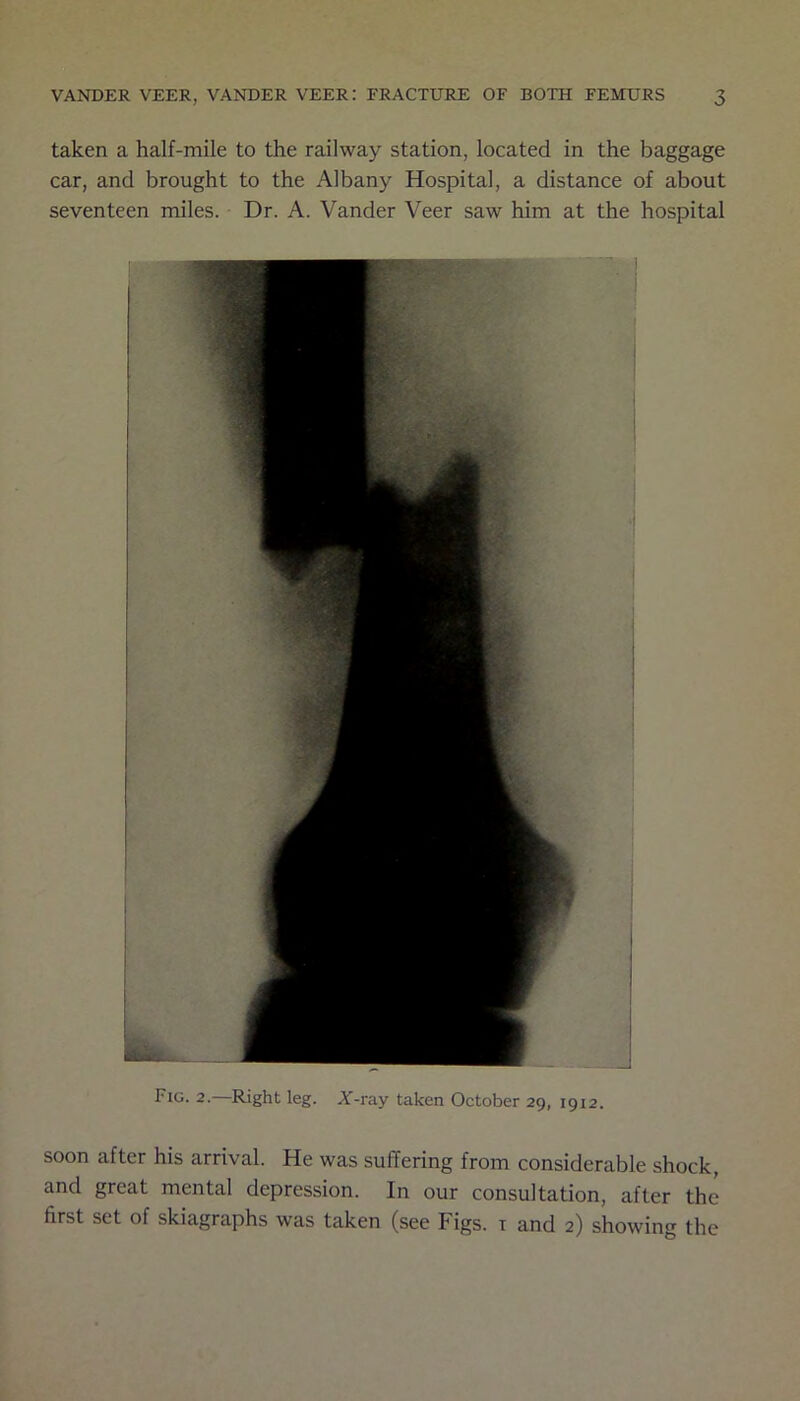 taken a half-mile to the railway station, located in the baggage car, and brought to the Albany Hospital, a distance of about seventeen miles. Dr. A. Vander Veer saw him at the hospital Fig. 2.—Right leg. AT-ray taken October 29, 1912. soon after his arrival. He was suffering from considerable shock, and great mental depression. In our consultation, after the first set of skiagraphs was taken (see Figs, i and 2) showing the