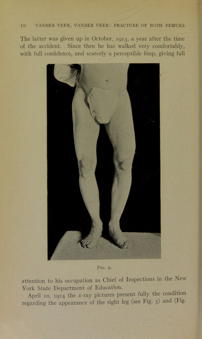 The latter was given up in October, 1913, a year after the time of the accident. Since then he has walked very comfortably, with full confidence, and scarcely a perceptible limp, giving full Fig. 9. attention to his occupation as Chief of Inspections in the New York State Department of Education. April 10, 1914 the a'-ray pictures present fully the condition regarding the appearance of the right leg (see Fig. 5) and (rig.