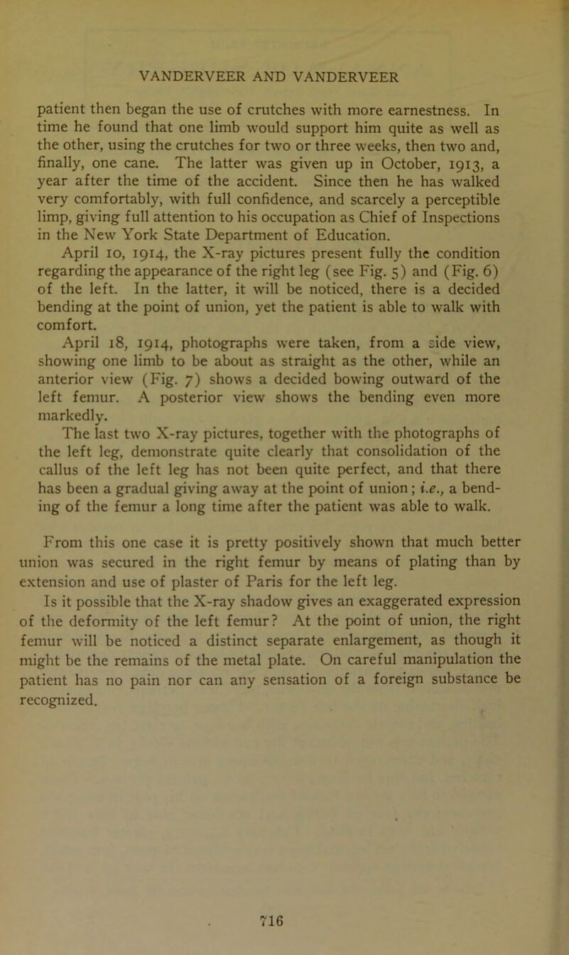 VANDERVEER AND VANDERVEER patient then began the use of crutches with more earnestness. In time he found that one limb would support him quite as well as the other, using the crutches for two or three weeks, then two and, finally, one cane. The latter was given up in October, 1913, a year after the time of the accident. Since then he has walked very comfortably, with full confidence, and scarcely a perceptible limp, giving full attention to his occupation as Chief of Inspections in the New York State Department of Education. April 10, 1914, the X-ray pictures present fully the condition regarding the appearance of the right leg (see Fig. 5) and (Fig. 6) of the left. In the latter, it will be noticed, there is a decided bending at the point of union, yet the patient is able to walk with comfort. April 18, 1914, photographs were taken, from a side view, showing one limb to be about as straight as the other, while an anterior view (Fig. 7) shows a decided bowing outward of the left femur. A posterior view shows the bending even more markedly. The last two X-ray pictures, together with the photographs of the left leg, demonstrate quite clearly that consolidation of the callus of the left leg has not been quite perfect, and that there has been a gradual giving away at the point of union; i.e., a bend- ing of the femur a long time after the patient was able to walk. From this one case it is pretty positively shown that much better union was secured in the right femur by means of plating than by extension and use of plaster of Paris for the left leg. Is it possible that the X-ray shadow gives an exaggerated expression of the deformity of the left femur? At the point of union, the right femur will be noticed a distinct separate enlargement, as though it might be the remains of the metal plate. On careful manipulation the patient has no pain nor can any sensation of a foreign substance be recognized.