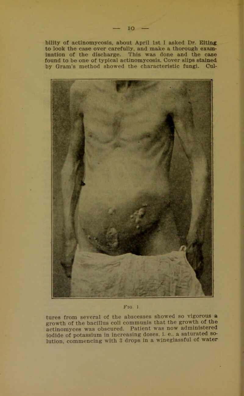 IO bility of actinomycosis, about April 1st I asked Dr. Elting to look the case over carefully, and make a thorough exam- ination of the discharge. This was done and the case found to be one of typical actinomycosis. Cover slips stained by Gram’s method showed the characteristic fungi. Cul- Fig. 1 tures from several of the abscesses showed so vigorous a growth of the bacillus coli communis that the growth of the actinomyces was obscured. Patient was now administered iodide of potassium in increasing doses, i. e.. a saturated so- lution, commencing with 3 drops in a wineglassful of water