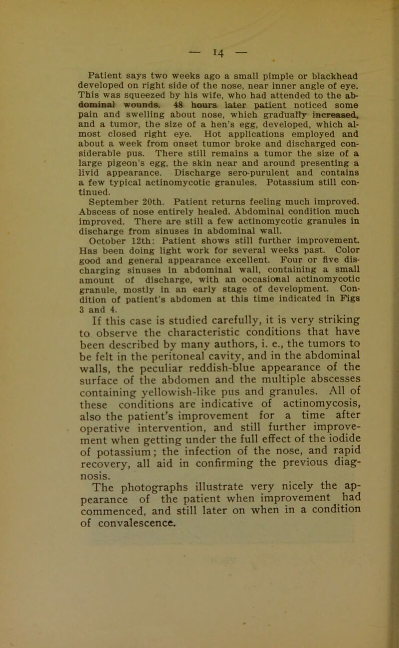 Patient says two weeks ago a small pimple or blackhead developed on right side of the nose, near inner angle of eye. This was squeezed by his wife, who had attended to the ab- dominal wounds. 48 hours later patient noticed some pain and swelling about nose, which gradually increased, and a tumor, the size of a hen’s egg, developed, which al- most closed right eye. Hot applications employed and about a week from onset tumor broke and discharged con- siderable pus. There still remains a tumor the size of a large pigeon’s egg, the skin near and around presenting a livid appearance. Discharge sero-purulent and contains a few typical actinomycotic granules. Potassium still con- tinued. September 20th. Patient returns feeling much improved. Abscess of nose entirely healed. Abdominal condition much improved. There are still a few actinomycotic granules in discharge from sinuses in abdominal wall. October 12th: Patient shows still further improvement Has been doing light work for several weeks past. Color good and general appearance excellent. Four or five dis- charging sinuses in abdominal wall, containing a small amount of discharge, with an occasional actinomycotic granule, mostly in an early stage of development Con- dition of patient’s abdomen at this time indicated in Figs 3 and 4. If this case is studied carefully, it is very striking to observe the characteristic conditions that have been described by many authors, i. e., the tumors to be felt in the peritoneal cavity, and in the abdominal walls, the peculiar reddish-blue appearance of the surface of the abdomen and the multiple abscesses containing yellowish-like pus and granules. All of these conditions are indicative of actinomycosis, also the patient’s improvement for a time after operative intervention, and still further improve- ment when getting under the full effect of the iodide of potassium; the infection of the nose, and rapid recovery, all aid in confirming the previous diag- nosis. The photographs illustrate very nicely the ap- pearance of the patient when improvement had commenced, and still later on when in a condition of convalescence.