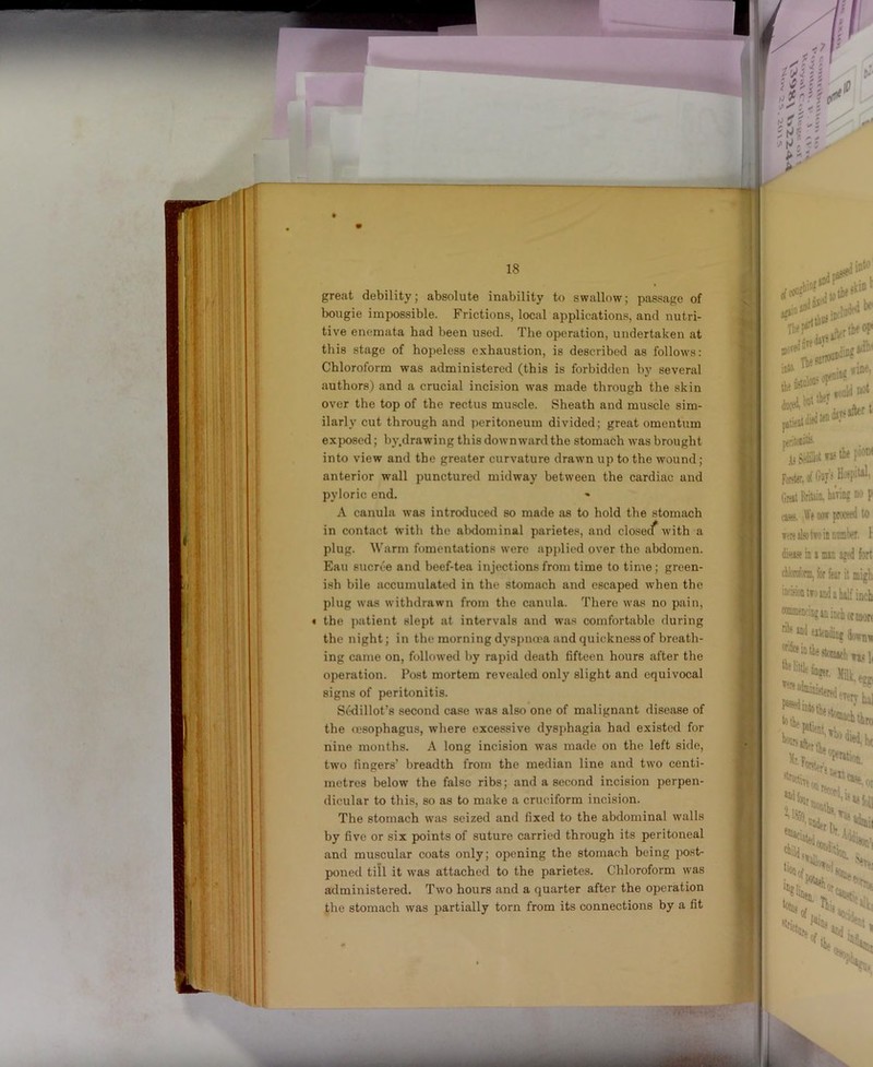 ♦ 18 great debility; absolute inability to swallow; passage of bougie impossible. Frictions, local applications, and nutri- tive enemata bad been used. The operation, undertaken at this stage of hopeless exhaustion, is described as follows: Chloroform was administered (this is forbidden by several authors) and a crucial incision was made through the skin over the top of the rectus muscle. Sheath and muscle sim- ilarly cut through and peritoneum divided; great omentum exposed; by.drawing this downward the stomach was brought into view and the greater curvature drawn up to the wound ; anterior wall punctured midway between the cardiac and pyloric end. A canula was introduced so made as to hold the stomach in contact with the abdominal parietes, and closecf with a plug. Warm fomentations were applied over the abdomen. Eau sucree and beef-tea injections from time to time; green- ish bile accumulated in the stomach and escaped when the plug was withdrawn from the canula. There was no pain, « the j)atient slept at intervals and was comfortable during the night; in the morning dyspnoea and quickness of breath- ing came on, followed by rapid death fifteen hours after the operation. Post mortem revealed only slight and equivocal signs of peritonitis. Sedillot’s second case was also one of malignant disease of the (I'sophagus, where excessive dysphagia had existed for nine months. A long incision was made on the left side, two fingers’ breadth from the median line and two centi- metres below the false ribs; and a second incision perpen- dicular to this, so as to make a cruciform incision. The stomach was seized and fixed to the abdominal walls by five or six points of suture carried through its peritoneal and muscular coats only; opening the stomach being post- poned till it was attached to the parietes. Chloroform was administered. Two hours and a quarter after the operation the stomach was partially torn from its connections by a fit