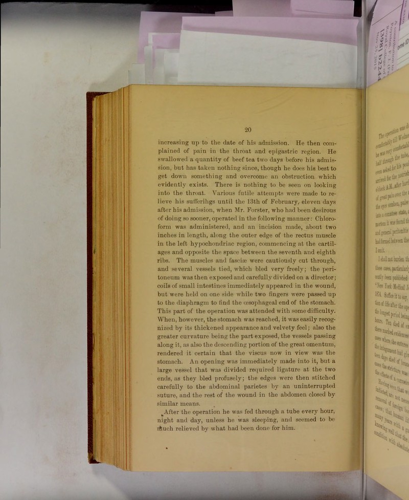 increasing up to tlie date of his admission. He then com- plained of pain in the throat and epigastric region. He swallowed a quantity of beef tea two days before his admis- sion, but has taken nothing since, though he does his best to get down something and overcome an obstruction which evidently exists. There is nothing to be seen on looking into the throat. Various futile attempts were made to re- lieve his suH'eriligs until the 13th of February, eleven days after his admission, when Mr. Forster, who had been desirous of doing so sooner, operated in the following manner: Chloro- form was administered, and an incision made, about two inches in length, along the outer edge of the rectus muscle in the left hypochondriac region, commencing at the cartil- ages and opposite the space between the seventh and eighth ribs. The muscles and fascite were cautiou.sly cut through, and .several ves.sels tied, which bled very freely; the j)eri- loneum was then exposed and carefully divided on a director; coils of small intestines immediately appeared in the wound, but were held on one side while two fingers were passed up to the diaphragm to find the (esojdiageal end of the stomach. This part of the operation was attended with .somedifliculty. When, however, the stomach was reached, it was easily recog- nized by its thickened apj)earance and velvety feel; also the greater curvature being the part exposed, the vessels passing along it, as also the descending jwrtion of the great omentum, rendered it certain that the viscus now in view was the stomach. An opening was immediately made into it, but a large vessel that w:is divided recjuired ligature at the two ends, as they bled profusely; the edges were then stitched carefully to the abdominal parietes by an uninterrupted suture, and the rest of the wound in the abdomen closed by similar means. ^After the operation he was fed through a tube every hour, night and day, unless he was sleeping, and seemed to be rfeuch relieved by what had been done for him.