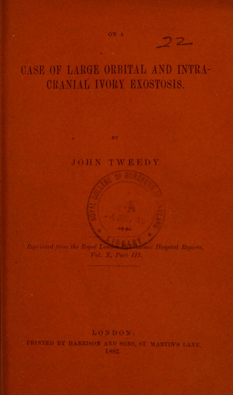 “2^. CASE OF LARGE ORBITAL AND INTRA CRANIAL IVORY EXOSTOSIS. JOHN TWEEDY. OrUlNTED BY HARRISON AND SONS, ST. MARTIN’S LAXE 1882.