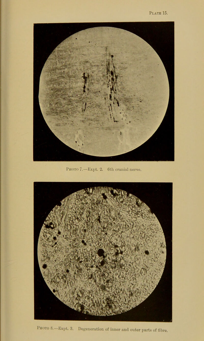 Photo 7.—Expt. 2. 6tli cj’anial nerve. Photo 8.—E.\pt. 3. Dofrcneration of inner and outer parts of fibre.