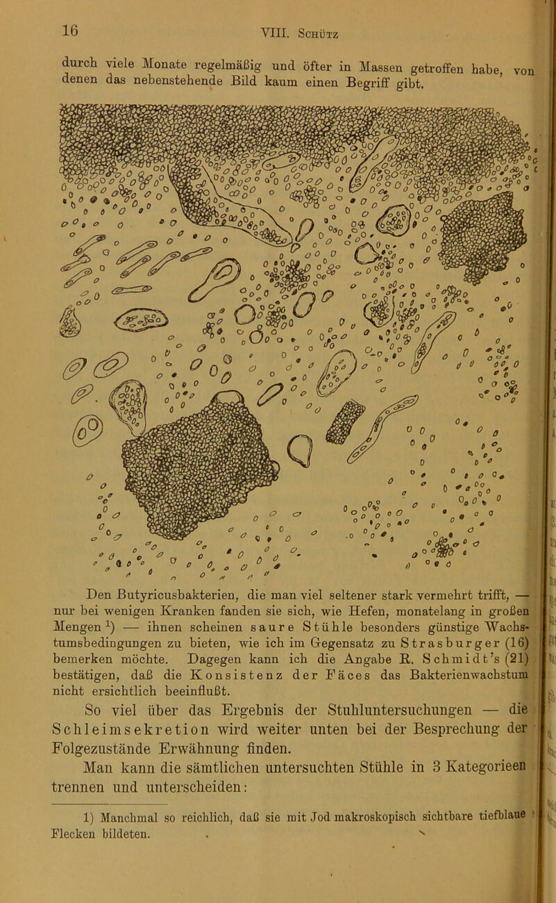 durch viele Monate regelmaBig und ofter in Massen getroffen habe, von denen das nebenstebende Bild kaum einen Begriff gibt. « 0 Den Butyricusbakterien, die man viel seltener stark vermebrt trifft, — nur bei wenigen Kranken fanden sie sieb, wie Hefen, monatelang in groBen Mengen x) — ihnen scbeinen saure Stiible besonders giinstige Wacbs- tumsbedingungen zu bieten, wie icb im Gegensatz zu Str as burger (16) bemerken mocbte. Dagegen kann icb die Angabe R. S ckmidt’s (21) bestatigen, daB die Konsistenz der Daces das Bakterienwacbstum nicbt ersicbtlich beeinfluBt. So viel liber das Ergebnis der Stubluntersucbungen Sclileimsekretion wird weiter unten bei der Besprechung der Folgezustande Erwabnung finden. Mail kann die samtliclien untersuchten Stiihle in 3 Kategorieen trennen und unterscbeiden: die 1) Manchmal so reiclilich, daB sie mit Jod makroskopisch sicbtbare tiefblaue Fleeken bildeten. . x ft