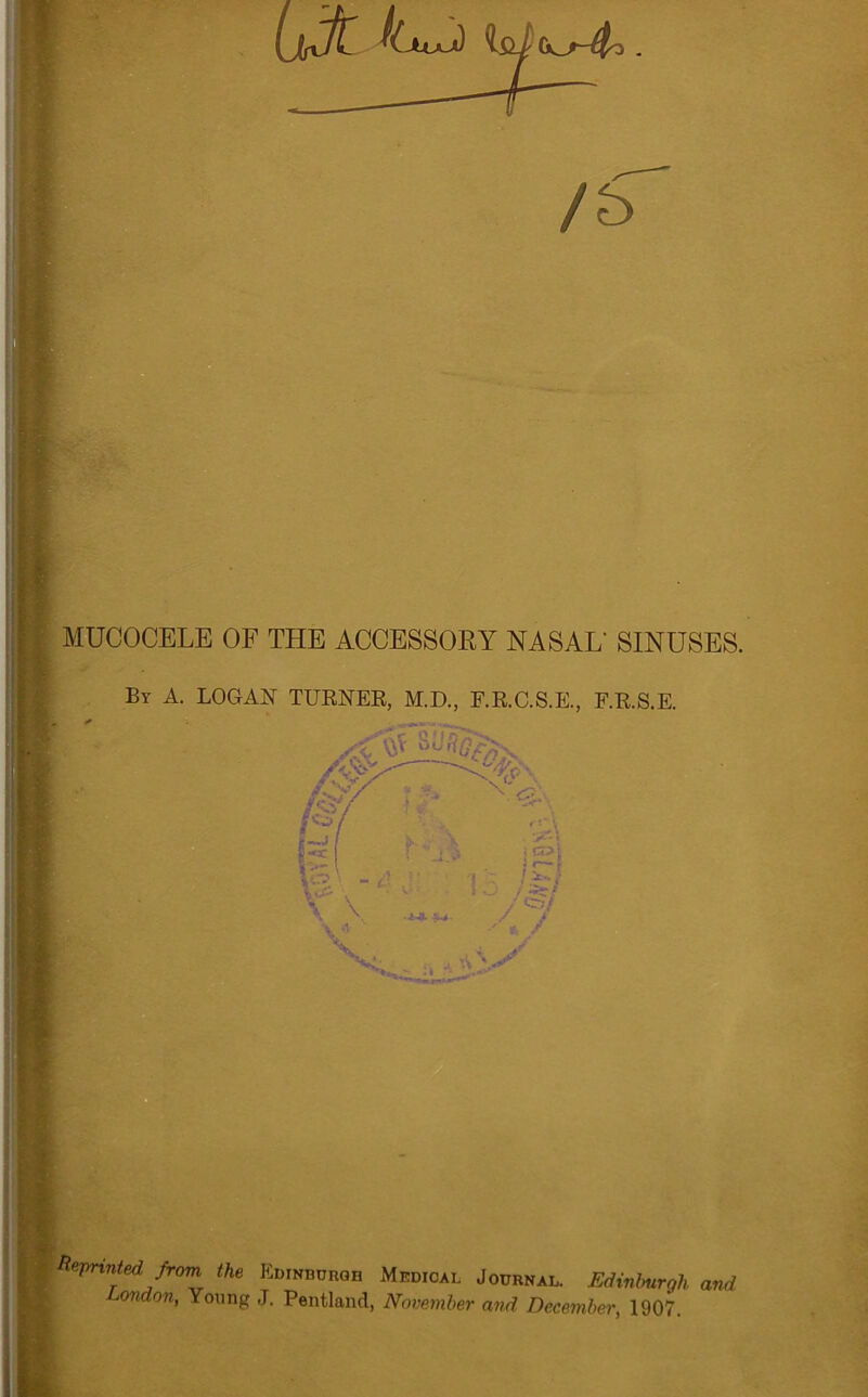 UfC ioi . /£> MUCOCELE OF THE ACCESSORY NASAL' SINUSES. By A. LOGAN TURNER, M.D., F.R.C.S.E., F.R.S.E. t Reprinted from the Edinburgh Medical Journal. Edinburgh and London, Young J. Pentland, November and December, 1907.