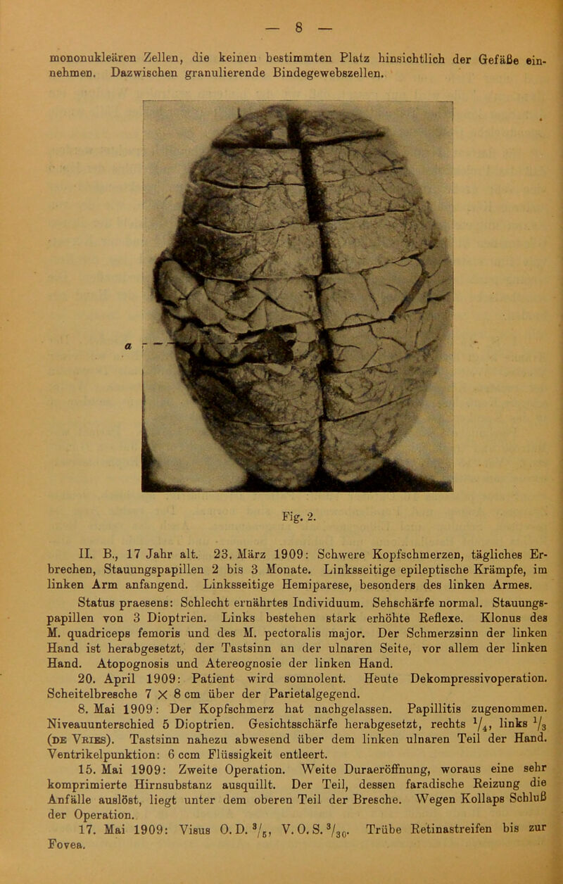 mononukleären Zellen, die keinen bestimmten Platz hinsichtlich der Gefäße ein- nehmen. Dazwischen granulierende Bindegewebszellen. II. B., 17 Jahr alt. 23. März 1909: Schwere Kopfschmerzen, tägliches Er- brechen, Stauungspapillen 2 bis 3 Monate. Linksseitige epileptische Krämpfe, im linken Arm anfangend. Linksseitige Hemiparese, besonders des linken Armes. Status praesens: Schlecht ernährtes Individuum. Sehschärfe normal. Stauungs- papillen von 3 Dioptrien. Links bestehen stark erhöhte Reflexe. Klonus des M. quadriceps femoris und des M. pectoralis major. Der Schmerzsinn der linken Hand ist herabgesetzt, der Tastsinn an der ulnaren Seite, vor allem der linken Hand. Atopognosis und Atereognosie der linken Hand. 20. April 1909: Patient wird somnolent. Heute Dekompressivoperation. Scheitelbresche 7 X 8 cm über der Parietalgegend. 8. Mai 1909: Der Kopfschmerz hat nachgelassen. Papillitis zugenommen. Niveauunterschied 5 Dioptrien. Gesichtsschärfe herabgesetzt, rechts 1/4i, links 1/3 (de Vries). Tastsinn nahezu abwesend über dem linken ulnaren Teil der Hand. Ventrikelpunktion: 6 ccm Flüssigkeit entleert. 15. Mai 1909: Zweite Operation. Weite Duraeröffnung, woraus eine sehr komprimierte Hirnsubstanz ausquillt. Der Teil, dessen faradische Reizung die Anfälle auslöst, liegt unter dem oberen Teil der Bresche. Wegen Kollaps Schluß der Operation. 17. Mai 1909: Visus O. D. 3/6, V. O. S. 3/30. Trübe Retinastreifen bis zur Fovea.