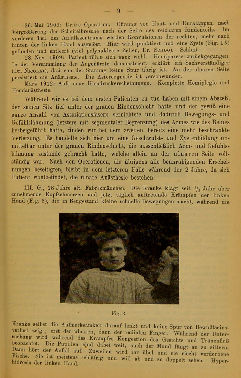 26. Mai 1909: Dritte Operation. Öffnung von Ilaut- und Duralappen, nach Vergrößerung der Scheilelbresche nach der Seite des reizbaren Rindenteils. Im vorderen Teil des Anfallszentrums werden Konvulsionen der rechten, mehr nach hinten der linken Hand ausgelöst. Hier wird punktiert und eine Zyste (Fig. 1 b) gefunden und entleert (viel polynukleäre Zellen, Dr. Schoo). Schluß. 28. Nov. 1909: Patient fühlt sich ganz wohl. Hemiparese zurückgegangen. In der Versammlung der Augenärzte demonstriert, erklärt ein Sachverständiger (Dr. Nicolai), daß von der Stauung keine Spur übrig ist. An der ulnaren Seite persistiert die Anästhesie. Die Astereognosie ist verschwunden. März 1912: Aufs neue Hirndruckerscheinungen. Komplette Hemiplegie und Hemianästhesie. Während wir es bei dem ersten Patienten zu tun haben mit einem Abszeß, der seinen Sitz tief unter der grauen Rindenschicht hatte und der gewiß eine ganze Anzahl von Assoziationsfasern vernichtete und dadurch Bewegungs- und Gefühlslähmung (letztere mit segmentaler Begrenzung) des Armes wie des Beines herbeigeführt hatte, finden wir bei dem zweiten bereits eine mehr beschränkte Verletzung. Es handelte sich hier um eine Geschwulst- und Zystenbildung un- mittelbar unter der grauen Rindenschicht, die ausschließlich Arm- und Gefühls- lähmung zustande gebracht hatte, welche allein an der ulnaren Seite voll- ständig war. Nach den Operationen, die übrigens alle beunruhigenden Erschei- nungen beseitigten, bleibt in dem letzteren Falle während der 2 Jahre, da sich Patient wohlbefindet, die ulnare Anästhesie bestehen. III. G., 18 Jahre alt, Fabrikmädchen. Die Kranke klagt seit 1/2 Jahr über zunehmende Kopfschmerzen und jetzt täglich auftretende Krämpfen der linken Hand (Fig. 3), die in Beugestand kleine schnelle Bewegungen macht, während die Fig. 8. Kranke selbst die Aufmerksamkeit darauf lenkt und keine Spur von Bewußtseins- verlust zeigt erst der ulnaren, dann der radialen Finger. Während der Unter- rt dCS KramPfes Kongestion des Gesichts und Tränenfluß Dann h^ l a?! ^ ^ Weit» aU°h der Muud «gt an zu zittern. Fische Sie ist ^.UfWeilen ,wird ihr übel sie riecht verdorbene UM der l“LrSl“d. g ”ä Wi“ “a “ d0PPe“ seh“- HW«
