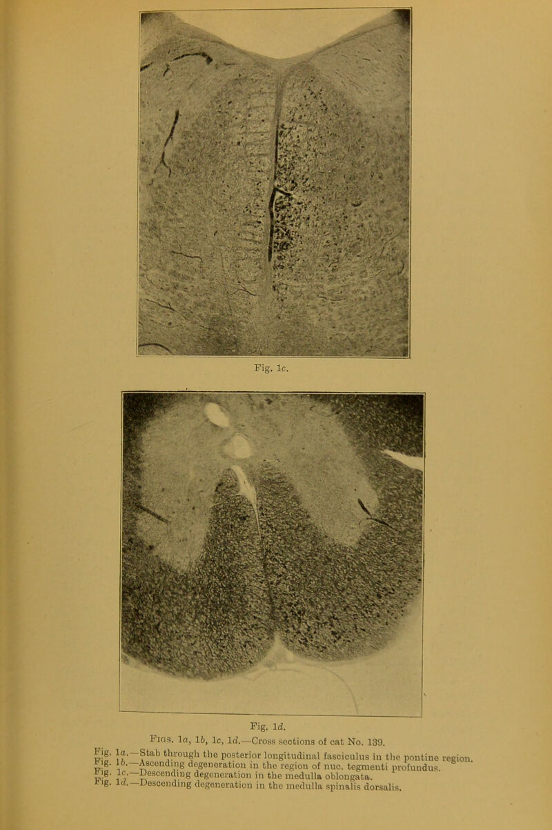 Fig. lc. Figs, la, lb, lc, lcl. Fig. Id. -Cross sections of cat No. 139. g. la. Stab through the posterior longitudinal fasciculus in the pontine region, g. l o. Ascending degeneration in the region of nuc. tegmeuti profundus, ig. lc. Descending degeneration in the medulla oblongata. *ig. la. Descending degeneration in the medulla spinalis dorsalis.