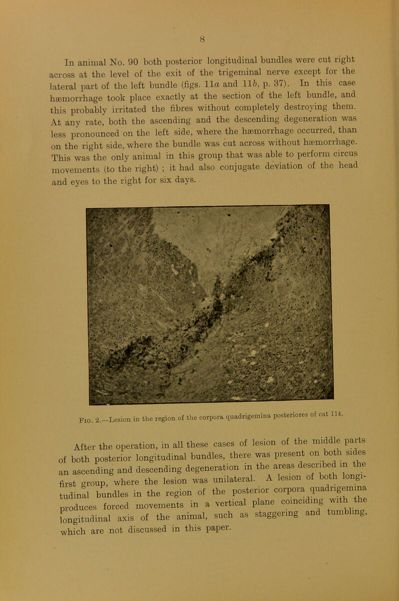 In animal No. 90 both posterior longitudinal bundles were cut right across at the level of the exit of the trigeminal nerve except for the lateral part of the left bundle (figs. 11a and 11&, p. 37). In this case haemorrhage took place exactly at the section of the left bundle, and this probably irritated the fibres without completely destroying them. At any rate, both the ascending and the descending degeneration was less pronounced on the left side, where the haemorrhage occurred, than on the right side, where the bundle was cut across without haemorrhage. This was the only animal in this group that was able to perform circus movements (to the right) ; it had also conjugate deviation of the head and eyes to the right for six days. Pig. 2.—Lesion in the region of the corpora quadrigemina posteriores of cat 114 After the operation, in all these cases of lesion of the middle parts of both posterior longitudinal bundles, there was present on both sides an ascending and descending degeneration m the areas described m e first group, where the lesion was unilateral. A lesion of both long tudinal bundles in the region of the posterior corpora quadrigemina produces forced movements in a vertical plane coinciding with longitudinal axis of the animal, such as staggering and tumbling, which are not discussed in this paper.