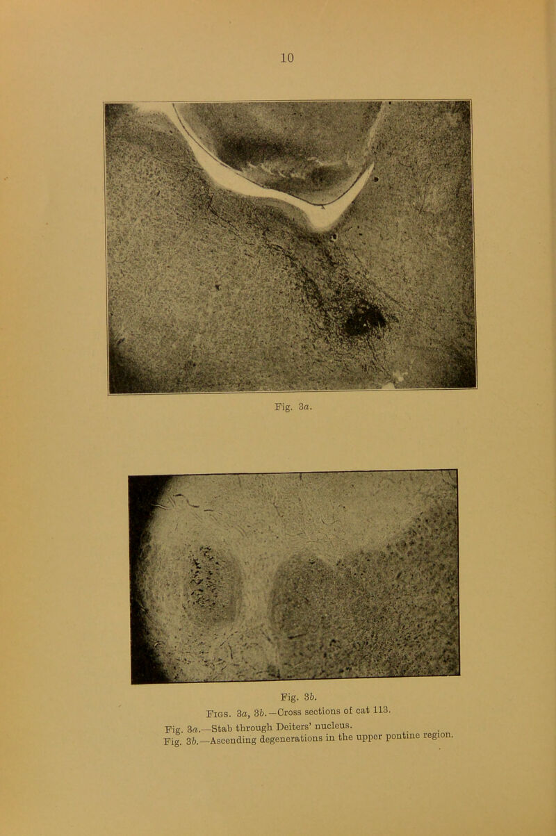 Fig. 3a. Fig. 36. Figs. 3a, 36.— Cross sections of cat 113. Fie. 3a.—Stab through Deiters’ nucleus. Fig. 36.—Ascending degenerations in the upper pontine region.