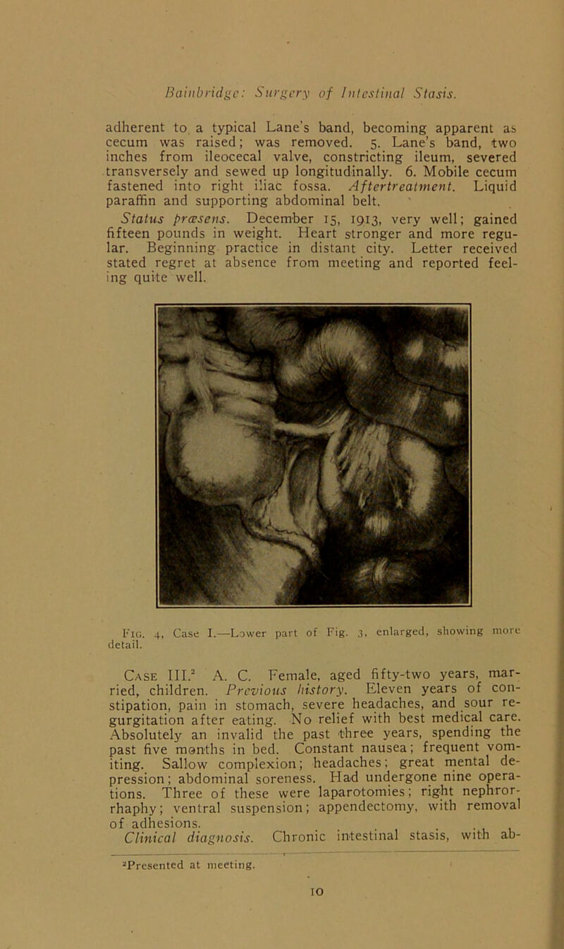 adherent to, a typical Lane's band, becoming apparent as cecum was raised; was removed. 5. Lane’s band, two inches from ileocecal valve, constricting ileum, severed transversely and sewed up longitudinally. 6. Mobile cecum fastened into right iliac fossa. Aftertreatment. Liquid paraffin and supporting abdominal belt. Status pressens. December 15, 1913, very well; gained fifteen pounds in weight. Heart stronger and more regu- lar. Beginning practice in distant city. Letter received stated regret at absence from meeting and reported feel- ing quite well. Case III.“ A. C. Female, aged fifty-two years, mar- ried, children. Previous history. Eleven years of con- stipation, pain in stomach, severe headaches, and sour re- gurgitation after eating. No relief with best medical care. .Absolutely an invalid the past three years, spending the past five months in bed. Constant nausea; frequent vom- iting. Sallow complexion; headaches; great inental de- pression; abdominal soreness. Had undergone nine opera- tions. Three of these were laparotomies; right nephror- rhaphy; ventral suspension; appendectomy, with removal of adhesions. ... ■ • 1 Clinical diagnosis. Chronic intestinal stasis, with ab- “Presented at meeting.