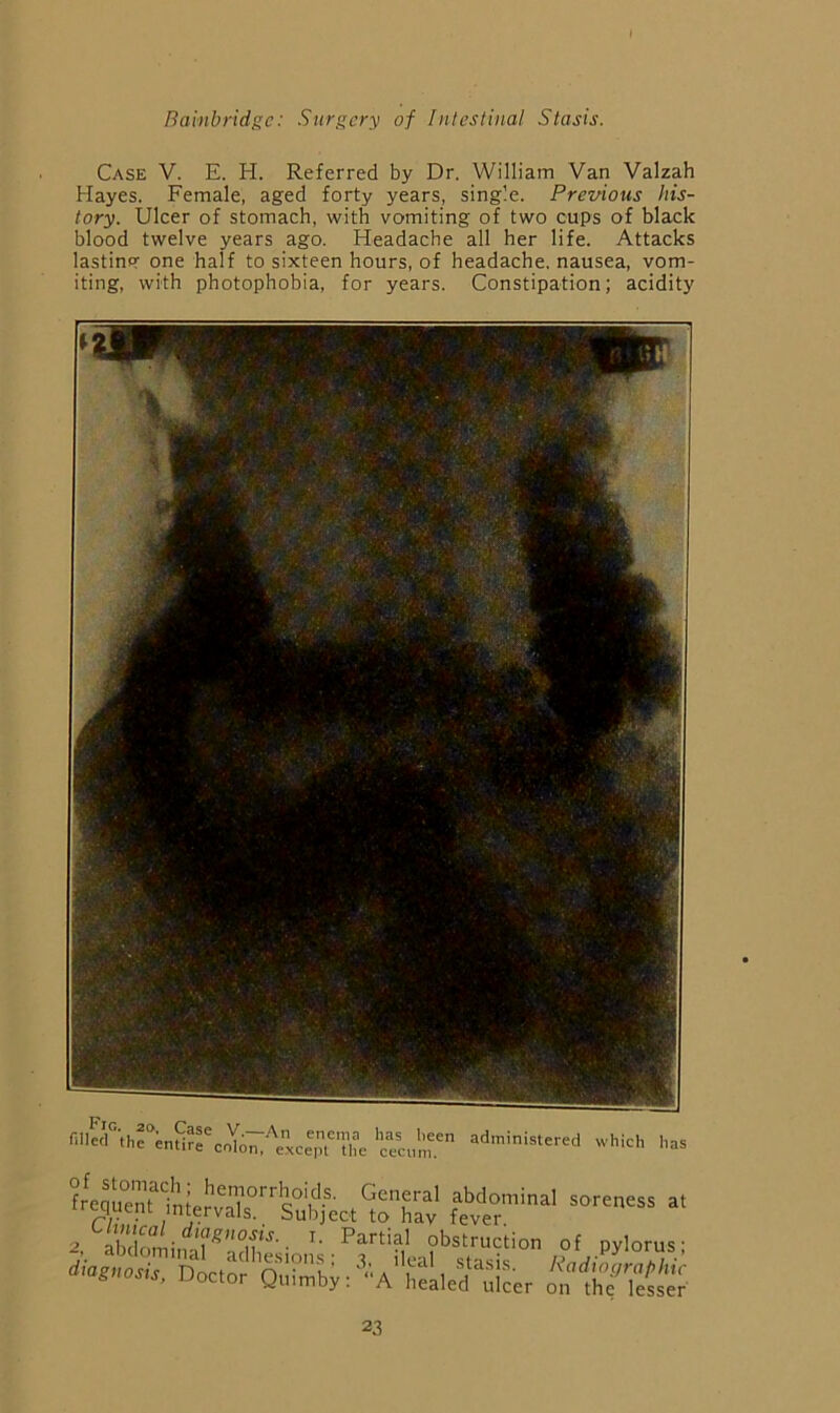 Case V. E. H. Referred by Dr. William Van Valzah Hayes. Female, aged forty years, single. Previous his- tory. Ulcer of stomach, with vomiting of two cups of black blood twelve years ago. Headache all her life. Attacks lastinPT one half to sixteen hours, of headache, nausea, vom- iting, with photophobia, for years. Constipation; acidity fM--' —- a. a. '■ obstruction of pylorus; V, Doctir Qnrb;:'’.'.A”£c!r„r:ijer o^lh^’lS