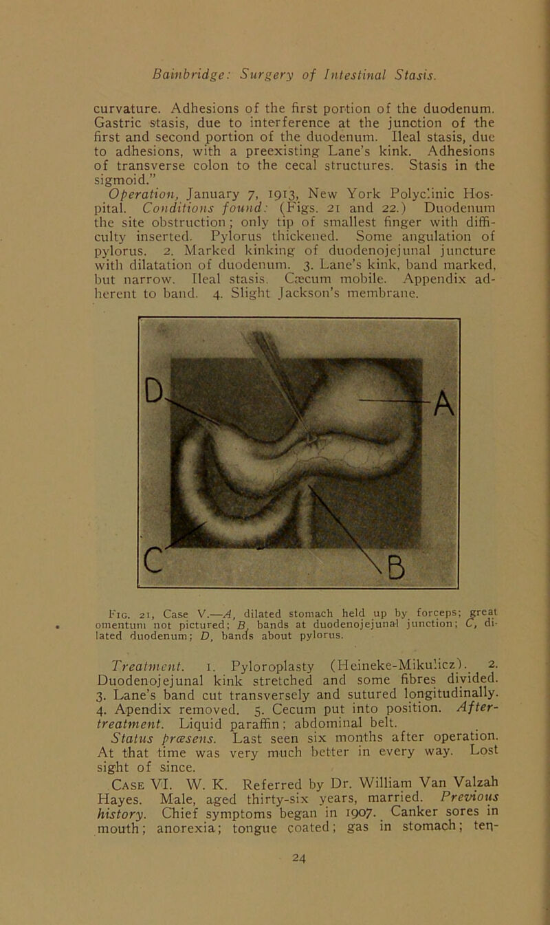 curvature. Adhesions of the first portion of the duodenum. Gastric stasis, due to interference at the junction of the first and second portion of the duodenum. Ileal stasis, due to adhesions, with a preexisting Lane’s kink. Adhesions of transverse colon to the cecal structures. Stasis in the sigmoid.” Operation, January 7, 1913, New York Polyclinic Hos- pital. Conditions found: (Figs. 21 and 22.) Duodenum the site obstruction ; only tip of smallest finger with diffi- culty inserted. Pylorus thickened. Some angulation of pylorus. 2. Marked kinking of duodenojejunal juncture with dilatation of duodenum. 3. Lane’s kink, band marked, but narrow. Ileal stasis. Crecum mobile. Appendix ad- herent to band. 4. Slight Jackson’s membrane. Fig. 21, Case V.—A, dilated stomach held up by forceps; great omentum not pictured; B bands at duodenojejunal junction; C, di- lated duodenum; D, bands about pylorus. Treatment. i. Pyloroplasty (Heineke-Miku’.icz_L_ 2. Duodenojejunal kink stretched and some fibres divided. 3. Lane’s band cut transversely and sutured longitudinally. 4. Apendix removed. 5. Cecum put into position. After- treatment. Liquid paraffin: abdominal belt. Status frcBsens. Last seen six months after operation. At that time was very much better in every way. Lost sight of since. Case VI. W. K. Referred by Dr. William Van Valzah Hayes. Male, aged thirty-six years, married. Previous history. Cbief symptoms began in 1907-. Canker sores in mouth; anorexia; tongue coated; gas in stomach; ten-