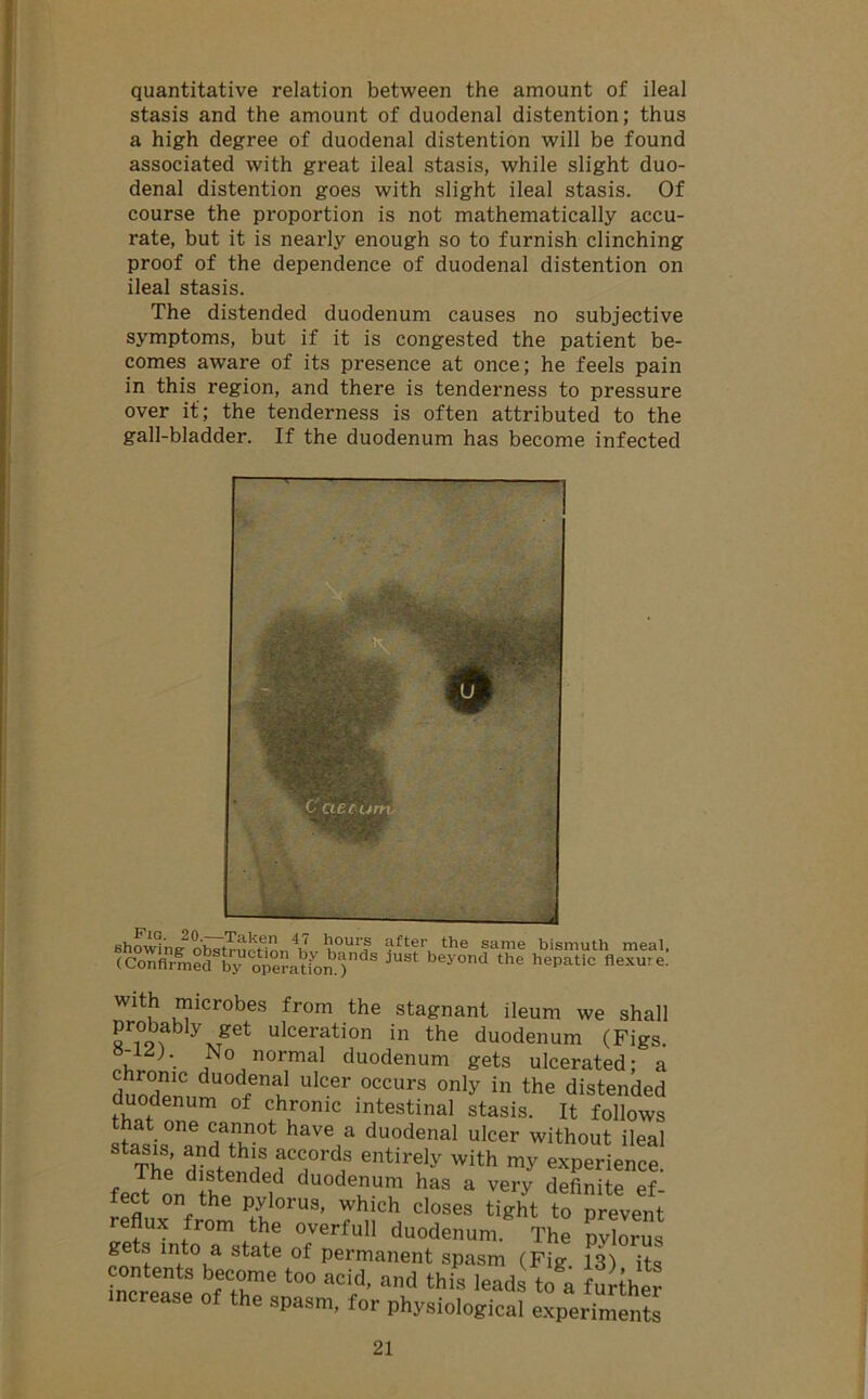 quantitative relation between the amount of ileal stasis and the amount of duodenal distention; thus a high degree of duodenal distention will be found associated with great ileal stasis, while slight duo- denal distention goes with slight ileal stasis. Of course the proportion is not mathematically accu- rate, but it is nearly enough so to furnish clinching proof of the dependence of duodenal distention on ileal stasis. The distended duodenum causes no subjective symptoms, but if it is congested the patient be- comes aware of its presence at once; he feels pain in this region, and there is tenderness to pressure over if; the tenderness is often attributed to the gall-bladder. If the duodenum has become infected shoe'lls oh^rTn! V 1?0Urf ;.lfter the same bismuth meal, (Confirmed by operation.)dS JUSt beyond the hepatic flexure. With microbes from the stagnant ileum we shall probably get ulceration in the duodenum (Figs. -LZ). No normal duodenum gets ulcerated; a ?lnoTC duo(lenal ulcer occurs on]y in the distended duodenum of chronic intestinal stasis. It follows that one cannot have a duodenal ulcer without ileal The * HTrdf 6ntirely with experience. fecthondl?p dU°deUm has a veiT definite ef- tect on the pylorus, which closes tight to prevent reflux from the overfull duodenum. The pvlorus gets into a state of permanent spasm (Fig 13) its ™ bfre 100 acid- ad thL leads to a further ncrease of the spasm, for physiological experiments
