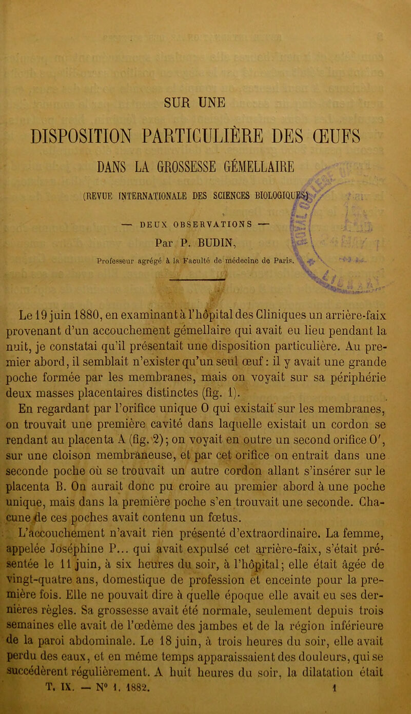 SUR UNE DISPOSITION PARTICULIÈRE DES ŒUFS DANS LA GROSSESSE GÉMELLAIRE (REVUE INTERNATIONALE DES SCIENCES BIOLOGIQUES) JW/ — DEUX OBSERVATIONS — . Par P. BUDIN, Professeur agrégé à la Faculté de médecine de Paris. .’jJj ' J - • ■ .- S : Le 19 juin 1880, en examinant à l’hôpital des Cliniques un arrière-faix provenant d’un accouchement gémellaire qui avait eu lieu pendant la nuit, je constatai qu’il présentait une disposition particulière. Au pre- mier abord, il semblait n’exister qu’un seul œuf : il y avait une grande poche formée par les membranes, mais on voyait sur sa périphérie deux masses placentaires distinctes (fîg. 1). En regardant par l’orifice unique O qui existait'sur les membranes, on trouvait une première cavité dans laquelle existait un cordon se rendant au placenta À (fîg. 2) ; on voyait en outre un second orifice O', sur une cloison membraneuse, et par cet orifice on entrait dans une seconde poche où se trouvait un autre cordon allant s’insérer sur le placenta B. On aurait donc pu croire au premier abord à une poche unique, mais dans la première poche s’en trouvait une seconde. Cha- cune <le ces poches avait contenu un fœtus. L’accouchement n’avait rien présenté d’extraordinaire. La femme, appelée Joséphine P... qui avait expulsé cet arrière-faix, s’était pré- sentée le 11 juin, à six heures du soir, à l’hôpital ; elle était âgée de vingt-quatre ans, domestique de profession et enceinte pour la pre- mière fois. Elle ne pouvait dire à quelle époque elle avait eu ses der- nières règles. Sa grossesse avait été normale, seulement depuis trois semaines elle avait de l’œdème des jambes et de la région inférieure de la paroi abdominale. Le 18 juin, à trois heures du soir, elle avait perdu des eaux, et en même temps apparaissaient des douleurs, qui se succédèrent régulièrement. A huit heures du soir, la dilatation était