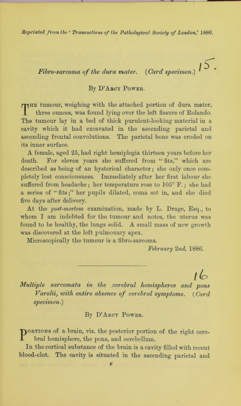 Reprinted from the * Transactions of the Pathological Society of London 1886. Fibrosarcoma of the dura mater. {Card specimen.) By D’Abcy Power. The tumour, weighing with the attached portion of dura mater, three ounces, was found lying over the left fissure of Rolando. The tumour lay in a bed of thick purulent-looking material in a cavity which it had excavated in the ascending parietal and ascending frontal convolutions. The parietal bone was eroded on its inner surface. A female, aged 25, had right hemiplegia thirteen years before her death. For eleven years she suffered from “ fits,” which are described as being of an hysterical character; she only once com- pletely lost consciousness. Immediately after her first labour she suffered from headache ; her temperature rose to 105° F.; she had a series of “ fitsher pupils dilated, coma set in, and she died five days after delivery. At the post-mortem examination, made by L. Drage, Esq., to whom I am indebted for the tumour and notes, the uterus was found to be healthy, the lungs solid. A small mass of new growth was discovered at the left pulmonary apex. Microscopically the tumour is a fibro-sarcoma. February 2nd, 1886. lb Multiple sarcomata in the cerebral hemispheres and pons Varolii, with entire absence of cerebral symptoms. {Card specimen.) By D’Arcy Power. Portions of a brain, viz. the posterior portion of the right cere- bral hemisphere, the pons, and cerebellum. In the cortical substance of the brain is a cavity filled with recent blood-clot. The cavity is situated in the ascending parietal and p