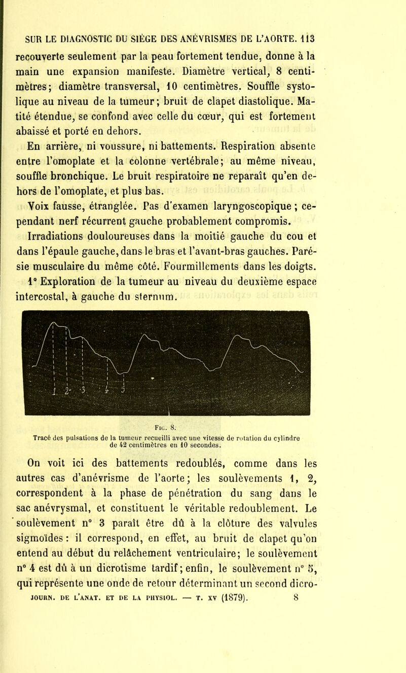 recouverte seulement par la peau fortement tendue, donne à la main une expansion manifeste. Diamètre vertical^ 8 centi- mètres; diamètre transversal, 10 centimètres. Souffle systo- lique au niveau de la tumeur; bruit de clapet diastolique. Ma- tité étendue, se confond avec celle du cœur, qui est fortement abaissé et porté en dehors. En arrière, ni voussure, ni battements. Respiration absente entre l’omoplate et la colonne vertébrale; au même niveau, souffle bronchique. Le bruit respiratoire ne reparaît qu’en de- hors de l’omoplate, et plus bas. I Voix fausse, étranglée. Pas d’examen laryngoscopique ; ce- j pendant nerf récurrent gauche probablement compromis, j Irradiations douloureuses dans la moitié gauche du cou et I dans l’épaule gauche, dans le bras et l’avant-bras gauches. Paré- I sie musculaire du même côté. Fourmillements dans les doigts. 1® Exploration de la tumeur au niveau du deuxième espace intercostal, à gauche du sternum. Fig. 8. Tracé des pulsations de la tumeur recueilli avec une vitesse de rotation du cylindre de 42 centimètres en 10 secondes. On voit ici des battements redoublés, comme dans les autres cas d’anévrisme de Paorte; les soulèvements 1, 2, correspondent à la phase de pénétration du sang dans le sac anévrysmal, et constituent le véritable redoublement. Le soulèvement n° 3 paraît être dû à la clôture des valvules sigmoïdes : il correspond, en effet, au bruit de clapet qu’on entend au début du relâchement ventriculaire; le soulèvement n® 4 est dû à un dicrotisme tardif; enfin, le soulèvement n“ 5, qui représente une onde de retour déterminant un second dicro- JOURN. DE l’aNAT. ET DE LA PHYSIOL. — T. XV (1879). 8