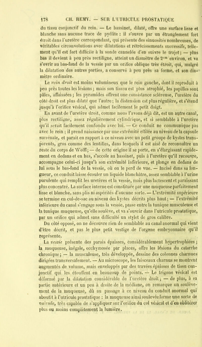 du tissu conjonctif du rein. — Le bassinet, dilaté, oITre une surface lisse et blanche sans aucune trace de pyélite : il s’ouvre par un étranglement fort étroit dans l'urelère correspondant, qui présente des sinuosités nombreuses, de véritables circonvolutions avec dilatations et rétrécissements successifs, telle- ment (ju’il est fort difficile à la sonde cannelée d'en suivre le trajet; — plus bas il devient à peu près rectiligne, atteint un diamètre de 2'“ environ, et va s’ovrirau bas-fond de la vessie par un orilice oblique très étroit, qui, malgré la dilatation des autres parties, a conservé à peu près sa forme, et son dia- mètre ordinaire. Le rem droit est moins volumineux que le rein gauche, dont il reproduit à peu [)rès toutes les lésions ; mais son tisssu est plus atrophié, les papilles sont pâles, affaissées; les pyramides olîrent une consistance scléreuse, l’urelère du coté droit est plus dilaté que l’autre; la distension est plus régulière, et s’étend jus(ju’à l’orifice vésical, qui admet facilement le pelil doigt. En avant de l’urelère droit, comme nous l’avons déjà dit, est un a\itre canal, plus rectiligne, assez régulièrement cylindrique, et si semblable à l’uretère qu’il serait facilement confondu avec lui. — Ce ccmduit ne communique pas avec le rein ; il prend naissance par une extrémité effilée au niveau delà capsule surrénale, et paraît en rapport à ce niveau avec un petit groupe de kystes trans- parents, gros comme des lentilles, dans lesquels il est aisé de reconnaître un reste du corps de Wolff; — de celle origine il se porte, en s’élargissant rapide- ment en dedans et en bas, s’accole au bassinet, puis à l’uretère qu’il recouvre, accompagne celui-ci jusqu’à son extrémité inférieure, et plonge en dedans de lui sous le bas-fond de la vessie, où on le perd de vue. — Incisé dans sa lon- gueur, ce conduit laisse écouler un liquide blanchâtre, assez semblable à l’urine purulente qui remplit les uretères et la vessie, mais plus lactescent et paraissant plus concentré. La surface interne est constituée par une muqueuse parfaitement lisse et blanche, sans plis ni aspérités d’aucune sorte.— L’extrémité supérieure se termine en cul-de-sac au niveau des kystes décrits plus haut; — Texlrémilé inférieure du canal s’engage sous la vessie, passe entre la tunique musculeuse et la tunique muqueuse, qu’elle soulève, et va s’ouvrir dans l’utricule prostatique, par un orifice qui admet sans difficulté un stylet de gros calibre. Du côté opposé, on ne découvre rien de semblable au canal anormal qui vient d’être décrit, et pas le plus petit vestige de l’organe embryonnaire qu’il représente. La vessie présente des parois épaisses, considérablement hypertrophiées ; la muqueuse, inégale, ecchymosée par places, oflre les lésions du catarrhe chronique; — la musculeuse, très développée, dessine des colonnes charnues dirigées transversalement. — Au microscope, les faisceaux charnus se montrent augmentés de volume, mais enveloppés par des travées épaisses de tissu con- jonctif qui les étouffent en beaucoup de points. — Le trigone vésical est déformé par la dilatation considérable de l’uretère droit ; — de plus, à sa partie antérieure et un peu à droite de la médiane, on remarque un soulève- ment de la muqueuse, dû au passage à ce niveau du conduit anormal qui aboutit à l’utricule prostatique : la muqueuse ainsi soulevée forme une sorte de valvule, très capable de s’appliquer sur rorilice du col vésical etd en oblitérer plus ou moins complètement la lumière.