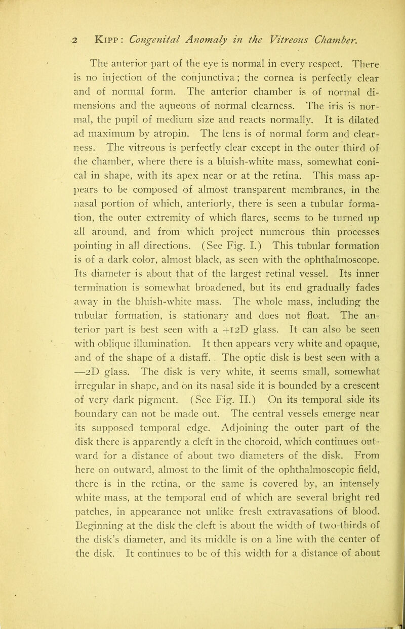 The anterior part of the eye is normal in every respect. There is no injection of the conjunctiva; the cornea is perfectly clear and of normal form. The anterior chamber is of normal di- mensions and the aqueous of normal clearness. The iris is nor- mal, the pupil of medium size and reacts normally. It is dilated ad maximum by atropin. The lens is of normal form and clear- ness. The vitreous is perfectly clear except in the outer third of the chamber, where there is a bluish-white mass, somewhat coni- cal in shape, with its apex near or at the retina. This mass ap- pears to be composed of almost transparent membranes, in the nasal portion of which, anteriorly, there is seen a tubular forma- tion, the outer extremity of which flares, seems to be turned up all around, and from which project numerous thin processes pointing in all directions. (See Fig. I.) This tubular formation is of a dark color, almost black, as seen with the ophthalmoscope. Its diameter is about that of the largest retinal vessel. Its inner termination is somewhat broadened, but its end gradually fades away in the bluish-white mass. The whole mass, including the tubular formation, is stationary and does not float. The an- terior part is best seen with a +12D glass. It can also be seen with oblique illumination. It then appears very white and opaque, ^uid of the shape of a distaff. The optic disk is best seen with a —2D glass. The disk is very white, it seems small, somewhat irregular in shape, and on its nasal side it is bounded by a crescent of very dark pigment. (See Fig. II.) On its temporal side its boundary can not be made out. The central vessels emerge near its supposed temporal edge. Adjoining the outer part of the disk there is apparently a cleft in the choroid, which continues out- Vv'ard for a distance of about two diameters of the disk. From here on outward, almost to the limit of the ophthalmoscopic field, there is in the retina, or the same is covered by, an intensely white mass, at the temporal end of which are several bright red patches, in appearance not unlike fresh extravasations of blood. Beginning at the disk the cleft is about the width of two-thirds of the disk’s diameter, and its middle is on a line with the center of the disk. It continues to be of this width for a distance of about