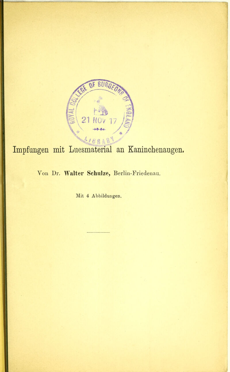 Impfungen mit Luesmaterial an Kaninchenaugen. Von Dr. Walter Schulze, Berlin-Friedenau.
