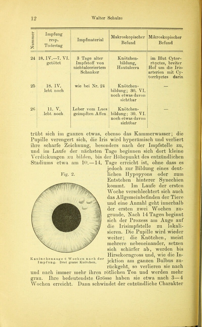 Nummer || Impfung resp. Todestag Impfmaterial Makroskopischer Befund Mikroskopischer Befund 24 18. IV—7. VI. getötet 3 Tage alter Impfstoff von nichtulceriertem Schanker Knötchen- bildung, Hautulcera im Blut Cytor- rhyetes, breiter Hof um die Iris- arterien mit Cy- torrhyetes darin 25 18. IV. lebt noch wie bei Nr. 24 Knötchen- bildung; 30. VI. noch etwas davon sichtbar 26 11. V. lebt noch Leber vom Lues geimpften Affen Knötchen- bildung; 30. VI. noch etwas davon sichtbar trübt sich im ganzen etwas, ebenso das Kammerwasser; die Pupille verengert sich, die Iris wird hyperämisch und verliert ihre scharfe Zeichnung, besonders nach der Impfstelle zu, und im Laufe der nächsten Tage beginnen sich dort kleine Verdickungen zu bilden, bis der Höhepunkt des entzündlichen Stadiums etwa am 10.—14. Tage erreicht ist, ohne dass es jedoch zur Bildung eines deut- Fig. 2. liehen Hypopyons oder zum Entstehen hinterer Synechien kommt. Im Laufe der ersten Woche verschlechtert sich auch das Allgemeinbefinden der Tiere und eine Anzahl geht innerhalb der ersten zwei Wochen zu- grunde. Nach 14 Tagen beginnt sich der Prozess am Auge auf die Irisimpfstelle zu lokali- sieren. Die Pupille wird wieder weiter; die Knötchen, meist mehrere nebeneinander, setzen sich schärfer ab, werden bis Hirsekorngross und, wie die In- Impfung. Drei graue Knötchen. jektlOn aiU gaUZeU BuloUS ZU- rückgeht, so verlieren sie nach und nach immer mehr ihren rötlichen Ton und werden mehr grau. Ihre bedeutendste Grösse haben sie etwa nach 3—4 Wochen erreicht. Dann schwindet der entzündliche Charakter