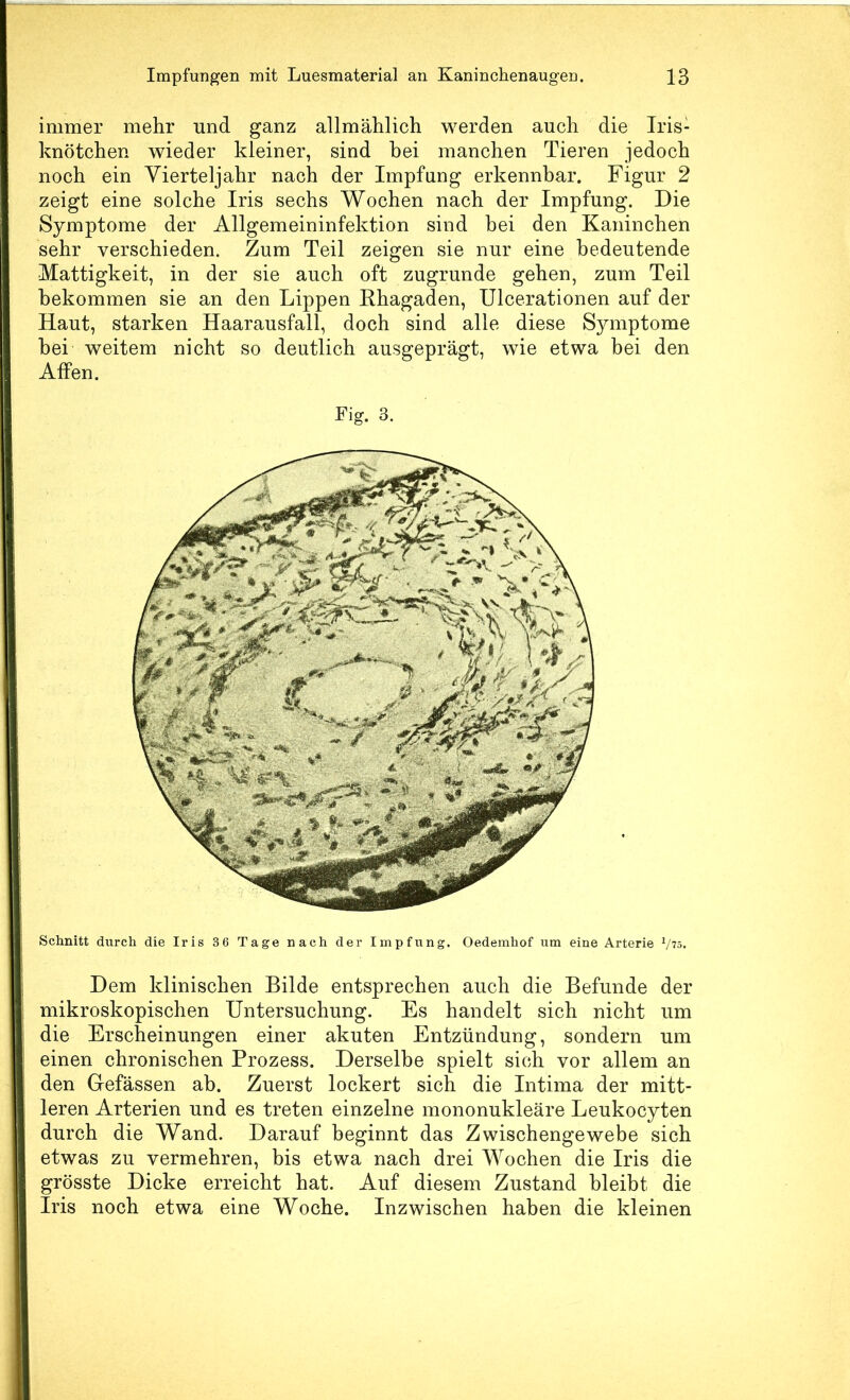 immer mehr und ganz allmählich werden auch die Iris- knötchen wieder kleiner, sind hei manchen Tieren jedoch noch ein Vierteljahr nach der Impfung erkennbar. Figur 2 zeigt eine solche Iris sechs Wochen nach der Impfung. Die Symptome der Allgemeininfektion sind bei den Kaninchen sehr verschieden. Zum Teil zeigen sie nur eine bedeutende Mattigkeit, in der sie auch oft zugrunde gehen, zum Teil bekommen sie an den Lippen Rhagaden, ülcerationen auf der Haut, starken Haarausfall, doch sind alle diese S3unptome hei weitem nicht so deutlich ausgeprägt, wie etwa bei den Affen. Fig. 3. Schnitt durch die Iris 36 Tage nach der Impfung. Oedemhof um eine Arterie V75- Dem klinischen Bilde entsprechen auch die Befunde der mikroskopischen Untersuchung. Es handelt sich nicht um die Erscheinungen einer akuten Entzündung, sondern um einen chronischen Prozess. Derselbe spielt sich vor allem an den Gefässen ab. Zuerst lockert sich die Intima der mitt- leren Arterien und es treten einzelne mononukleäre Leukocyten durch die Wand. Darauf beginnt das Zwischengewebe sich etwas zu vermehren, bis etwa nach drei Wochen die Iris die grösste Dicke erreicht hat. Auf diesem Zustand bleibt die Iris noch etwa eine Woche. Inzwischen haben die kleinen