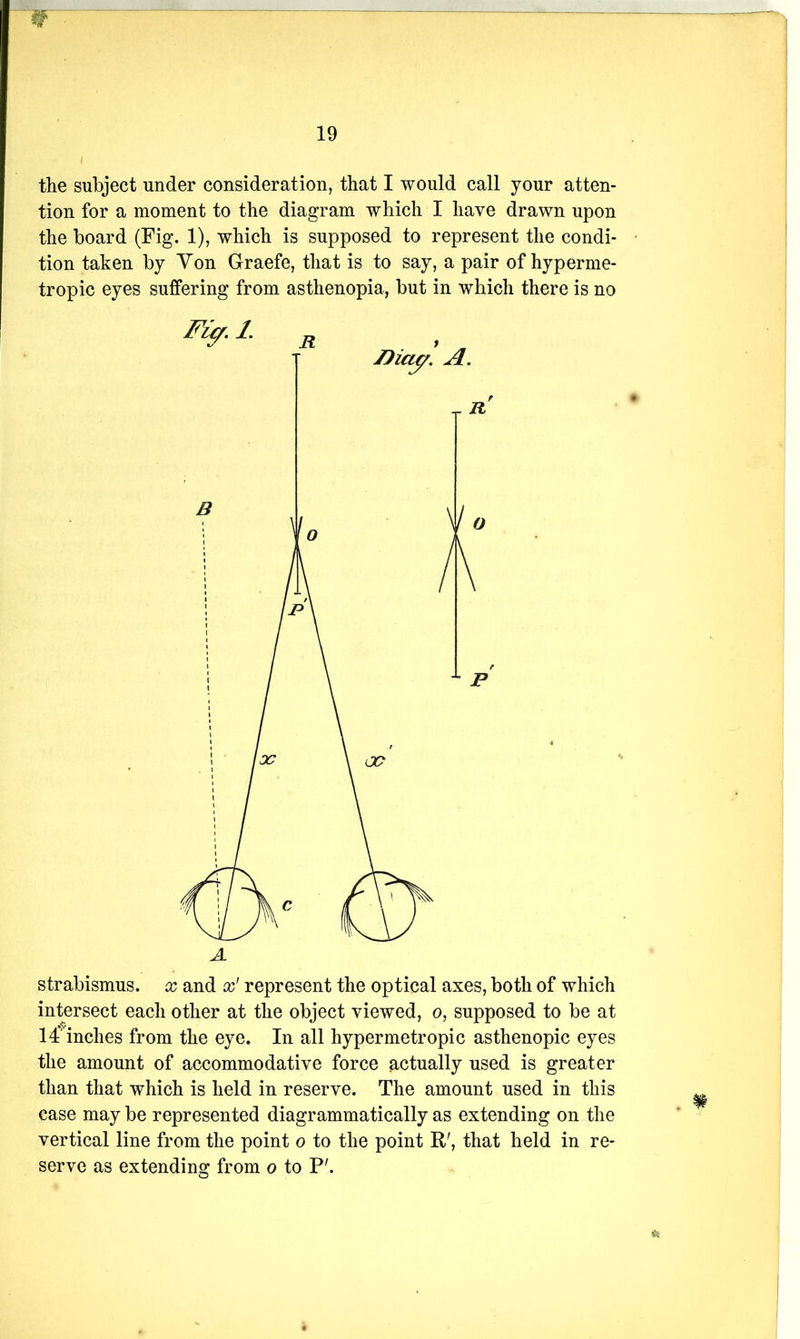the subject under consideration, that I would call your atten- tion for a moment to the diagram which I have drawn upon the board (Fig. 1), which is supposed to represent the condi- tion taken by Yon Graefe, that is to say, a pair of hyperme- tropic eyes suffering from asthenopia, but in which there is no strabismus, x and x' represent the optical axes, both of which intersect each other at the object viewed, o, supposed to be at 14’‘inches from the eye. In all hypermetropic asthenopic eyes the amount of accommodative force actually used is greater than that which is held in reserve. The amount used in this case may be represented diagrammatically as extending on the vertical line from the point o to the point R', that held in re- serve as extending from o to P'.