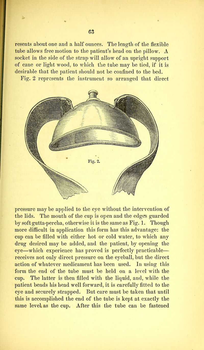 resents about one and a half ounces. The length of the flexible tube allows free motion to the patient’s head on the pillow. A socket in the side of the strap will allow of an upright support of cane or light wood, to which the tube may be tied, if it is desirable that the patient should not be confined to the bed. Fig. 2 represents the instrument so arranged that direct pressure may be applied to the eye without the intervention of the lids. The mouth of the cup is open and the edges guarded by soft gutta-percha, otherwise it is the same as Fig. 1. Though more difficult in application this form has this advantage: the cup can be filled with either hot or cold water, to which any drug desired may be added, and the patient, by opening the eye—which experience has proved is perfectly practicable— receives not only direct pressure on the eyeball, but the direct action of whatever medicament has been used. In using this form the end of the tube must be held on a level with the cup. The latter is then filled with the liquid, and, while the patient bends his head well forward, it is carefully fitted to the eye and securely strapped. But care must be taken that until this is accomplished the end of the tube is kept at exactly the same level as the cup. After this the tube can be fastened