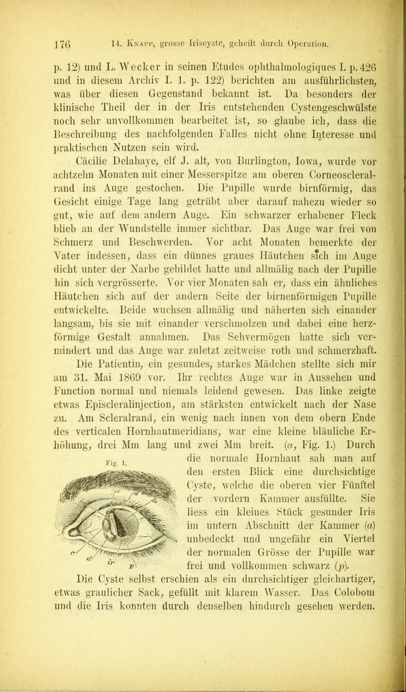 p. 12) und L. Wecker in seinen Etiides oplitlialmologiqiies I. p.426 und in diesem Archiv I. 1. p. 122) berichten am ausführlichsten^ was über diesen Gegenstand bekannt ist. Da besonders der klinische Theil der in der Iris entstehenden Cystengeschwülste noch sehr unvollkommen bearbeitet ist, so glaube ich, dass die Beschreibung des nachfolgenden Falles nicht ohne Interesse und praktisclien Nutzen sein wird. Ccäcilie Delahaye, elf J. alt, von Burlington, Iowa, wurde vor achtzehn Monaten mit einer Messerspitze am oberen Corneoscleral- rand ins Auge gestochen. Die Pupille wurde hirnförmig, das Gesicht einige Tage lang getrübt aber darauf nahezu wieder so gut, wie auf dem andern Auge. Ein scliwarzer erhabener Fleck blieb an der Wundstelle immer sichtbar. Das Auge war frei von Schmerz und Beschwerden. Vor acht Monaten bemerkte der Vater indessen, dass ein dünnes graues Häutchen s7ch im Auge dicht unter der Narbe gebildet hatte und allmälig nach der Pupille hin sich vergrösserte. Vor vier Monaten sali er, dass ein ähnliches Häutchen sich auf der andern Seite der birnenförmigen Pupille entwickelte. Beide wuchsen allmälig und näherten sich einander langsam, bis sie mit einander verschmolzen und dabei eine herz- förmige Gestalt annahmen. Das Sehvermögen hatte sich ver- mindert und das Auge war zuletzt zeitweise roth und schmerzhaft. Die Patientin, ein gesundes, starkes Mädchen stellte sich mir am 31. Mai 1869 vor. Ihr rechtes Auge war in Aussehen und Function normal und niemals leidend gewesen. Das linke zeigte etwas Episcleralinjection, am stärksten entwickelt nach der Nase zu. Am Scleralrand, ein wenig nach innen von dem obern Ende des verticalen Hornhautmeridians, war eine kleine bläuliche Er- höhung, drei Mm lang und zwei Mm breit, (a, Eig. 1.) Durch die normale Hornhaut sah man auf den ersten Blick eine durchsichtige C'yste, welche die oberen vier Fünftel der vordem Kammer ausfüllte. Sie Hess ein kleines Stück gesunder Iris im untern Abschnitt der Kammer (a) unbedeckt und ungefähr ein Viertel der normalen Grösse der Pupille war frei und vollkommen schwarz (p). Die Cyste selbst erschien als ein durchsichtiger gleichartiger, etwas graulicher Sack, gefüllt mit klarem Wasser. Das Colobom und die Iris konnten durch denselben hindurch gesehen werden.