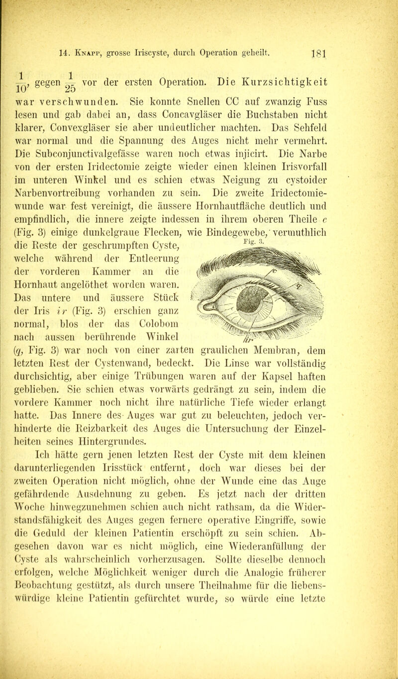 gegen ^ vor der ersten Operation. Die Kurzsichtigkeit rig. 3. war verschwunden. Sie konnte Snellen CG auf zwanzig Fuss lesen und gab dabei an, dass Concavgläser die Buchstaben nicht klarer, Convexgläser sie aber undeutlicher machten. Das Sehfeld war normal und die Spannung des Auges nicht mehr vermehrt. Die Suhconjunctivalgefässe waren noch etwas iiijicirt. Die Narbe von der ersten Iridectomie zeigte wieder einen kleinen Irisvorfall im unteren Winkel und es schien etwas Neigung zu cystoider Narbenvortreibung vorhanden zu sein. Die zweite Iridectomie- wunde war fest vereinigt, die äussere Hornhautfläche deutlich und empflndlich, die innere zeigte indessen in ihrem oberen Theile c (Fig. 3) einige dunkelgraue Flecken, wie Bindegewebe,'vermuthlich die Reste der geschrumpften Cyste, welche während der Entleerung der vorderen Kammer an die Hornhaut angelöthet worden waren. Das untere und äussere Stück der Iris ir (Fig. 3) erschien ganz normal, blos der das Colobom nach aussen berührende Winkel (g, Fig. 3) war noch von einer zarten letzten Rest der Cystenwand, bedeckt, durchsichtig, aber einige Trübungen waren auf der Kapsel haften geblieben. Sie schien etwas vorwärts gedrängt zu sein, indem die vordere Kammer noch nicht ihre natürliche Tiefe wieder erlangt hatte. Das Innere des- Auges war gut zu beleuchten, jedoch ver- hinderte die Reizbarkeit des Auges die Untersuchung der Einzel- heiten seines Hintergrundes. Ich hätte gern jenen letzten Rest der Cyste mit dem kleinen darunterliegenden Irisstück entfernt, doch war dieses bei der zweiten Operation nicht möglich, ohne der Wunde eine das Auge gefährdende Ausdehnung zu geben. Es jetzt nach der dritten Woche hinwegzunehmen schien auch nicht rathsam, da die Wider- standsfähigkeit des Auges gegen fernere operative Eingriffe, sowie die Geduld der kleinen Patientin erschöpft zu sein schien. Ab- gesehen davon war es nicht möglich, eine Wiederanfüllung der Cyste als wahrscheinlich vorherzusagen. Sollte dieselbe dennoch erfolgen, welche Möglichkeit weniger durch die Analogie früherer Beobachtung gestützt, als durch unsere Theilnahme für die liebens- würdige kleine Patientin gefürchtet wurde, so würde eine letzte graulichen Membran, dem Die Linse war vollständm