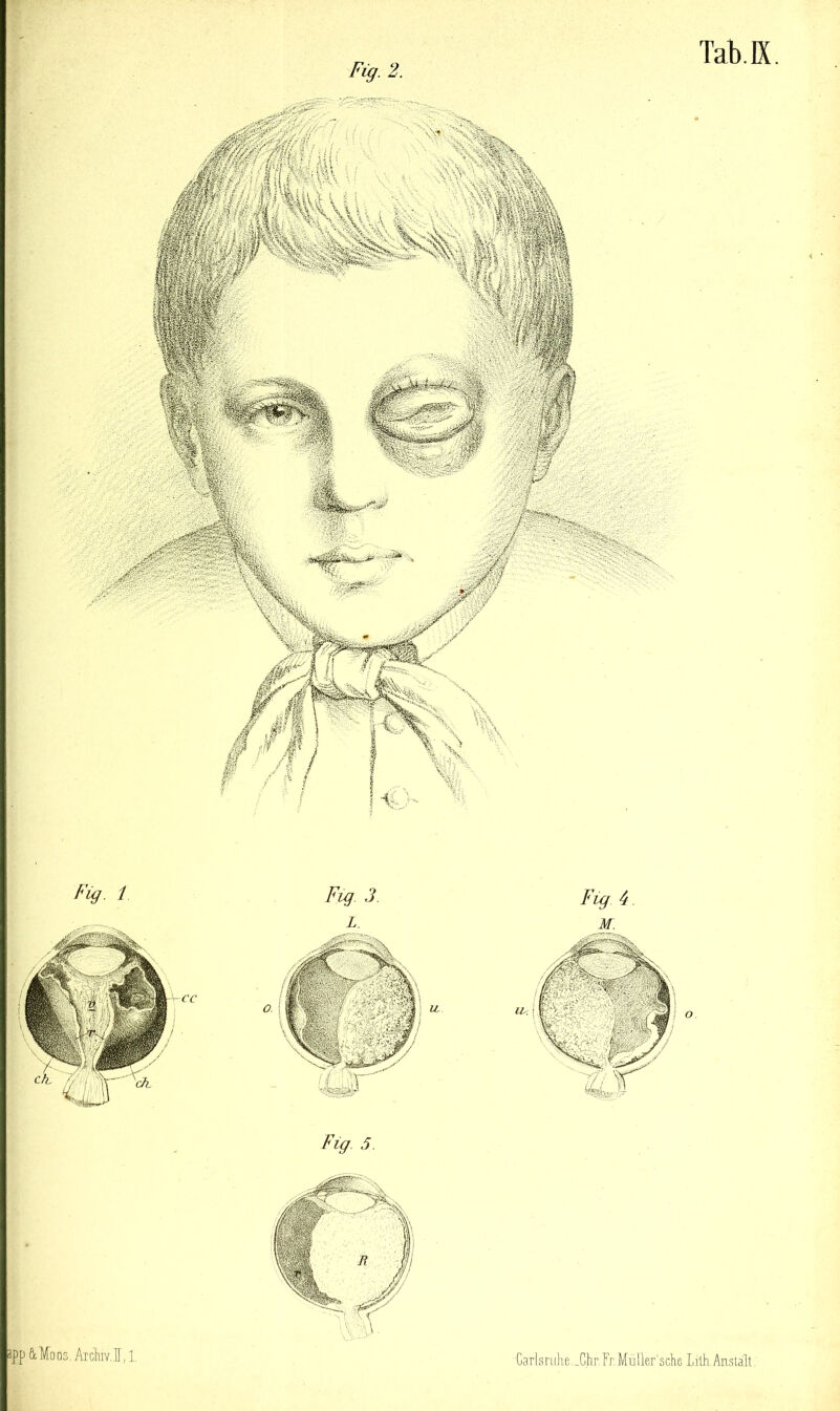 h'ig. i 3pp&Moos,ATchw.ir, 1. Fig. 2. Fig. 3. L Fig 5. Fig 4 M. Carlsnjhe.-Chr.Fr.Muller’sclie Lilh.Anstalt Tab.K.