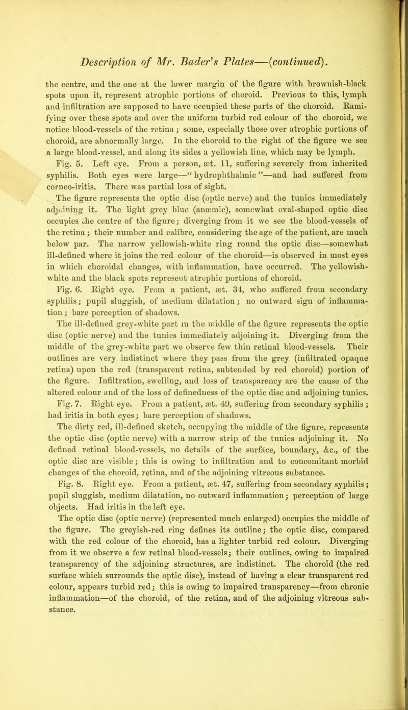 Description of Mr. Bader^s Plates—[continued). the centre, and the one at the lower margin of the figure with brownish-black spots upon it, represent atrophic portions of choroid. Previous to this, lymph and infiltration are supposed to have occupied these parts of the choroid. Rami- fying over these spots and over the uniform turbid red colour of the choroid, we notice blood-vessels of the retina ; some, especially those over atrophic portions of choroid, are abnormally large. In the choroid to the right of the figure we see a large blood-vessel, and along its sides a yellowish line, which may be lymph. Fig. 5. Left eye. From a person, set. 11, sutfering severely from inherited syphilis. Both eyes were large—“ hydrophthalmic ”—and had suffered from corneo-iritis. There was partial loss of sight. The figure represents the optic disc (optic nerve) and the tunics immediately adjt^iuing it. The light grey blue (aummic), somewhat oval-shaped optic disc occupies uhe centre of the figure; diverging from it we see the blood-vessels of the retina; their number and calibre, considering the age of the patient, are much below par. The narrow yellowish-white ring round the optic disc—somewhat ill-defined where it joins the red colour of the choroid—is observed in most eyes in which choroidal changes, with inflammation, have occurred. The yellowish- white and the black spots represent atrophic portions of choroid. Fig. 6. Right eye. From a patient, set. 34, who suffered from secondary syphilis; pupil sluggish, of medium dilatation; no outward sign of inflamma- tion ; bare perception of shadows. The ill-defined grey-white part in the middle of the figure represents the optic disc (optic nerve) and the tunics immediately adjoining it. Diverging from the middle of the grey-white part we observe few thin retinal blood-vessels. Their outlines are very indistinct where they pass from the grey (infiltrated opaque retina) upon the red (transparent retina, subtended by red choroid) portion of the figure. Infiltration, swelling, and loss of transparency are the cause of the altered colour and of the loss of defineduess of the optic disc and adjoining tunics. Fig. 7. Right eye. From a patient, mt. 49, suffering from secondary syphilis ; had iritis in both eyes; bare perception of shadows. The dirty red, ill-defined sketch, occupying the middle of the figure, represents the optic disc (optic nerve) with a narrow strip of the tunics adjoining it. No defined retinal blood-vessels, no details of the surface, boundary, &c., of the optic disc are visible; this is owing to infiltration and to concomitant morbid changes of the choroid, retina, and of the adjoining vitreous substance. Fig. 8. Right eye. From a patient, set. 47, suffering from secondary syphilis ; pupil sluggish, medium dilatation, no outward inflammation; perception of large objects. Had iritis in the left eye. The optic disc (optic nerve) (represented much enlarged) occupies the middle of the figure. The greyish-red ring defines its outline; the optic disc, compared with the red colour of the choroid, has a lighter turbid red colour. Diverging from it we observe a few retinal blood-vessels; their outlines, owing to impaired transparency of the adjoining structures, are indistinct. The choroid (the red surface which surrounds the optic disc), instead of having a clear transparent red colour, appears turbid red; this is owing to impaired transparency—from chronic inflammation—of the choroid, of the retina, and of the adjoining vitreous sub- stance.