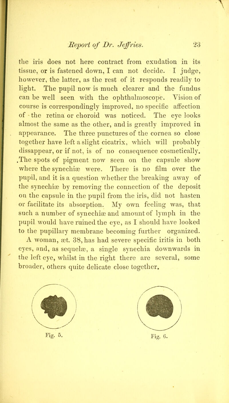 ■A Beport of Dr. Jeffries. 23 the iris does not here contract from exudation in its tissue, or is fastened down, I can not decide. I judge, however, the latter, as the rest of it responds readily to light. The pupil now is much clearer and the fundus can be well seen with the ophthalmoscope. Vision of course is correspondingly improved, no specific affection of ' the retina or choroid was noticed. The eye looks almost the same as the other, and is greatly improved in appearance. The three punctures of the cornea so close together have left a slight cicatrix, which will probably dissappear, or if not, is of no consequence cosmetically. .The spots of pigment now seen on the capsule show where the synechiae were. There is no film over the pupil, and it is a question whether the breaking away of the synechiae by removing the connection of the deposit on the capsule in the pupil from the iris, did not hasten or facilitate its absorption. My own feeling was, that such a number of synechiae and amount of lymph in the pupil would have ruined the eye, as I should have looked to the pupillary membrane becoming further organized. A woman, aet. 38, has had severe specific iritis in both eyes, and, as sequelae, a single synechia downwards in the left eye, whilst in the right there are several, some broader, others quite delicate close together.