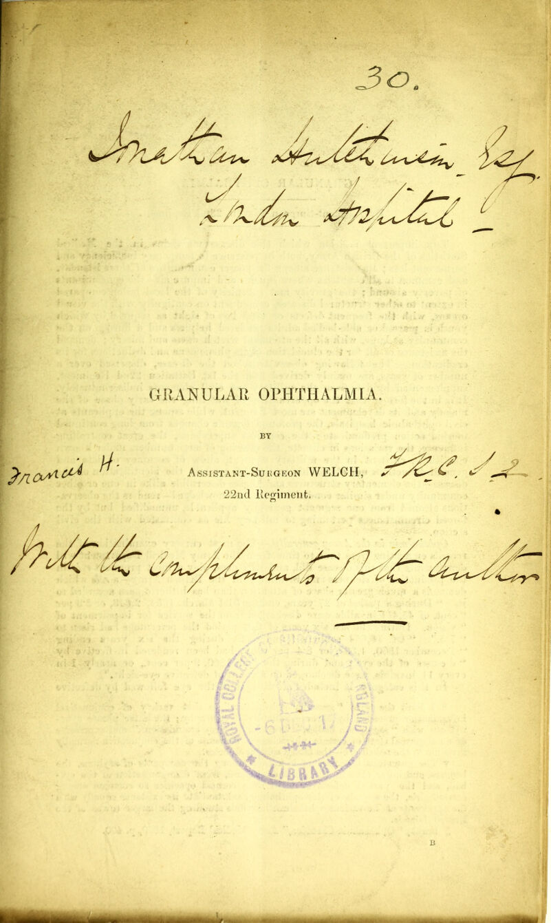 Jo GRANULAR OPHTHALMIA. i //■ Assistant-Surgeon WELCH. 22nd lleofiment.