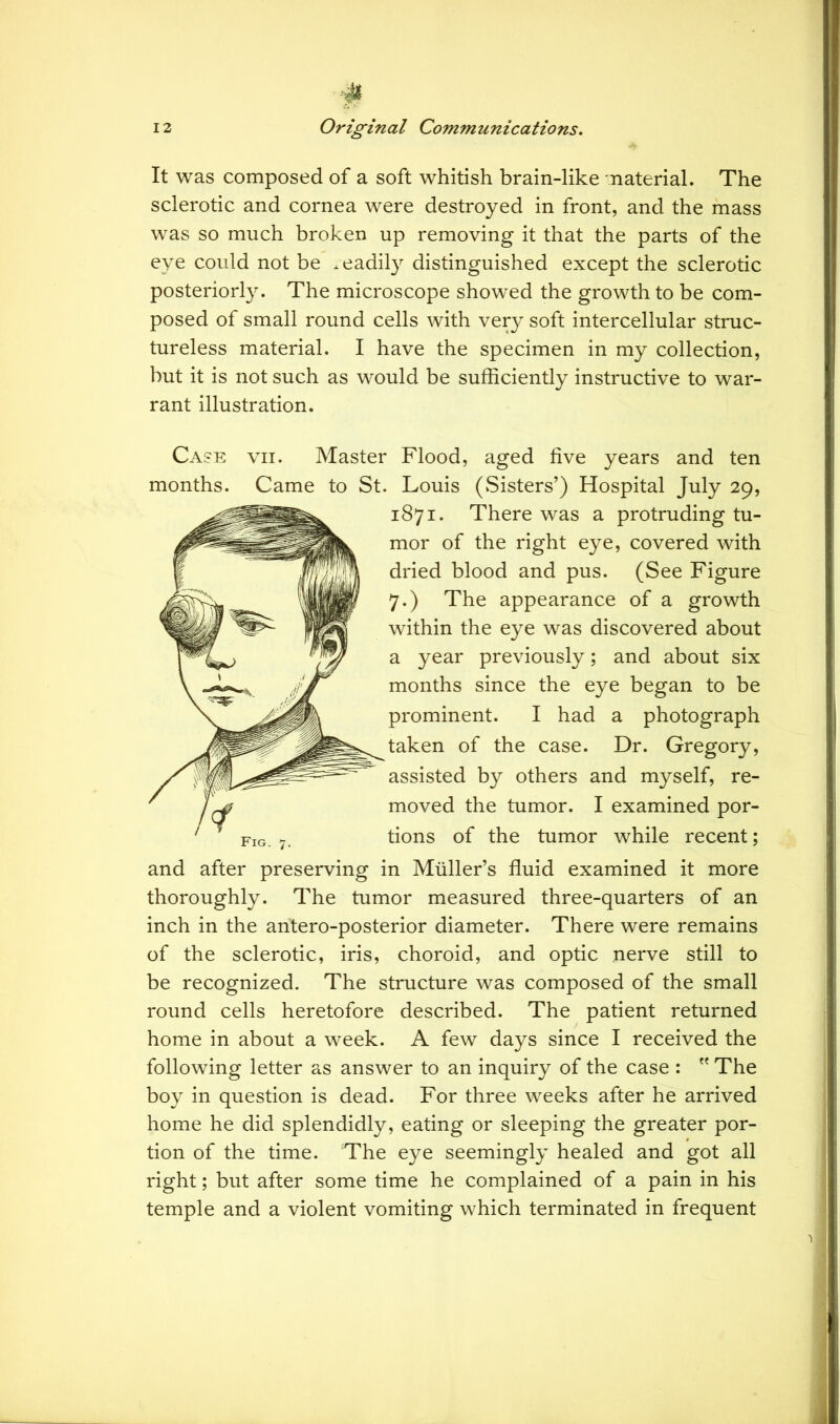 It was composed of a soft whitish brain-like material. The sclerotic and cornea were destroyed in front, and the mass was so much broken up removing it that the parts of the eye could not be .eadily distinguished except the sclerotic posteriorly. The microscope showed the growth to be com- posed of small round cells with very soft intercellular struc- tureless material. I have the specimen in my collection, but it is not such as would be sufficiently instructive to war- rant illustration. Case vii. Master Flood, aged five years and ten months. Came to St. Louis (Sisters’) Hospital July 29, 1871. There was a protruding tu- mor of the right eye, covered with dried blood and pus. (See Figure 7.) The appearance of a growth within the eye was discovered about a year previously; and about six months since the eye began to be prominent. I had a photograph taken of the case. Dr. Gregory, assisted by others and myself, re- moved the tumor. I examined por- tions of the tumor while recent; and after preserving in Muller’s fluid examined it more thoroughly. The tumor measured three-quarters of an inch in the antero-posterior diameter. There were remains of the sclerotic, iris, choroid, and optic nerve still to be recognized. The structure was composed of the small round cells heretofore described. The patient returned home in about a week. A few days since I received the following letter as answer to an inquiry of the case :  The boy in question is dead. For three weeks after he arrived home he did splendidly, eating or sleeping the greater por- tion of the time. The eye seemingly healed and got all right; but after some time he complained of a pain in his temple and a violent vomiting which terminated in frequent