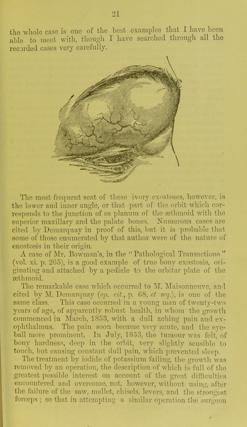 the whole case is one of the best examples that I have been able to meet with, though I have searched through all the recorded cases very carefully. The most frequent seat of these ivory exostoses, however, is the lower and inner angle, or that part of the orbit which cor- responds to the junction of os planum of the {ethmoid with the superior maxillary and the palate bones. Numerous cases are cited by Demarquay in proof of this, but it is probable that some of those enumerated by that author were of the nature of enostosis in their origin. A case of Mr. Bowman’s, in the “Pathological Transactions ” (vol. xi. p. 205), is a good example of true bony exostosis, 01 i- ginating and attached by a pedicle to the orbitar plate of the {ethmoid. The remarkable case which occurred to M. Maisonneuve, and cited by M. Demarquay {op. tit., p. 68, ct scq.), is one of the same class. This case occurred in a young man of twenty-two years of age, of apparently robust health, in whom the growth commenced in March, 1853, with a dull aching pain and ex- ophthalmus. The pain soon became very acute, and the eye- ball more prominent. In July, 1853, the tumour was felt, of bony hardness, deep in the orbit, very slightly sensible to touch, but causing constant dull pain, which prevented sleep. The treatment by iodide of potassium failing, the growth was removed by an operation, the description of which is full of the greatest possible interest on account of the great difficulties encountered and overcome, not, however, without using, after the failure of the saw, mallet, chisels, levers, and the strongest forceps ; so that in attempting a similar operation the surgeon d