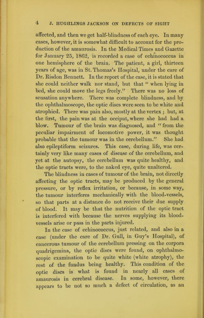 affected, and then we get half-blindness of each eye. In many cases, however, it is somewhat difficult to account for the pro- duction of the amaurosis. In the Medical Times and Gazette for January 25, 1862, is recorded a case of echinococcus in one hemisphere of the brain. The patient, a girl, thirteen years of age, was in St. Thomas’s Hospital, under the care of Dr. Risdon Bennett. In the report of the case, it is stated that she could neither walk nor stand, but that “ when lying in bed, she could move the legs freely.” There was no loss of sensation anywhere. There was complete blindness, and by the ophthalmoscope, the optic discs were seen to be white and atrophied. There was pain also, mostly at the vertex ; but, at the first, the pain was at the occiput, where she had had a blow. Tumour of the brain was diagnosed, and “ from the peculiar impairment of locomotive power, it was thought probable that the tumour was in the cerebellum.” She had also epileptiform seizures. This case, during life, was cer- tainly very like many cases of disease of the cerebellum, and yet at the autopsy, the cerebellum was quite healthy, and the optic tracts were, to the naked eye, quite unaltered. The blindness in cases of tumour of the brain, not directly affecting the optic tracts, may be produced by the general pressure, or by reflex irritation, or because, in some way, the tumour interferes mechanically with the blood-vessels, so that parts at a distance do not receive their due supply of blood. It may be that the nutrition of the optic tract is interfered with because the nerves supplying its blood- vessels arise or pass in the parts injured. In the case of echinococcus, just related, and also in a case (under the care of Dr. Gull, in Guy’s Hospital), of cancerous tumour of the cerebellum pressing on the corpora quadrigemina, the optic discs were found, on ophthalmo- scopic examination to be quite white (white atrophy), the rest of the fundus being healthy. This condition of the optic discs is what is found in nearly all cases of amaurosis in cerebral disease. In some, however, there appears to be not so much a defect of circulation, as an