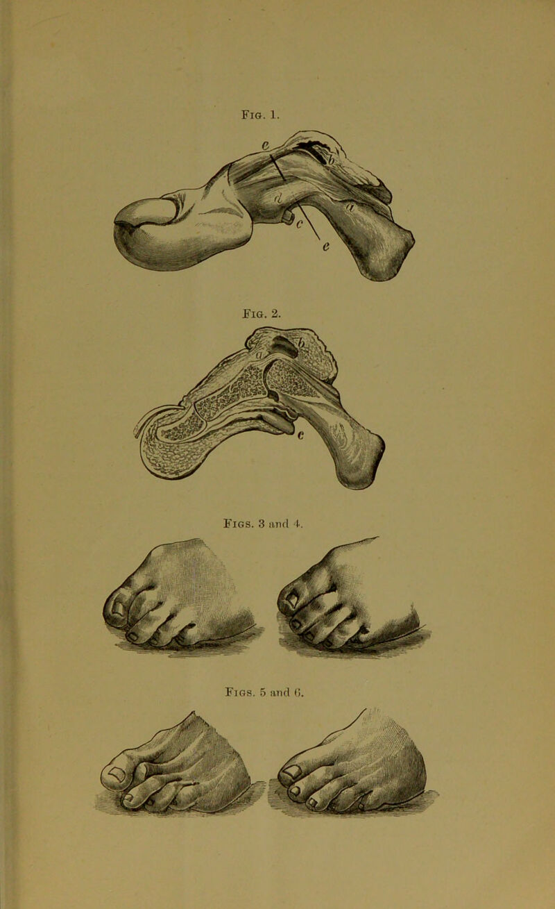 Fig. 2. Figs. 3 and 4.