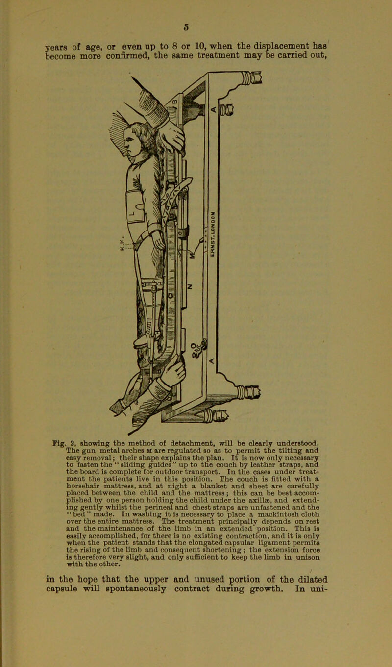 years of age, or even up to 8 or 10, when the displacement has become more confirmed, the same treatment may be carried out, Fig. 2, showing the method of detachment, will be clearly understood. The gun metal arches M are regulated so as to permit the tilting and easy removal; their shape explains the plan. It is now only necessary to fasten the “ sliding guides” up to the couch by leather straps, and the board is complete for outdoor transport. In the cases under treat- ment the patients live in this position. The couch is fitted with a horsehair mattress, and at night a blanket and sheet are carefully placed between the child and the mattress; this can be best accom- plished by one person holding the child under the axillae, and extend- ing gently whilst the perineal and chest straps are unfastened and the “ bed ” made. In washing it is necessary to place a mackintosh cloth over the entire mattress. The treatment principally depends on rest and the maintenance of the limb in an extended position. This is easily accomplished, for there is no existing contraction, and it is only when the patient stands that the elongated capsular ligament permits the rising of the limb and consequent shortening ; the extension force is therefore very slight, and only sufficient to keep the limb in unison with the other. in the hope that the upper and unused portion of the dilated capsule will spontaneously contract during growth. In uni-