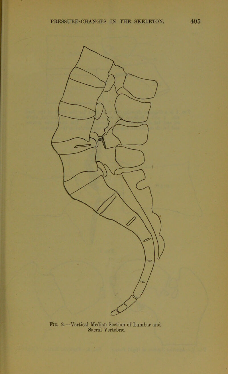 Fig. 2.—Vertical Median Section of Lumbar and Sacral Vertebra.