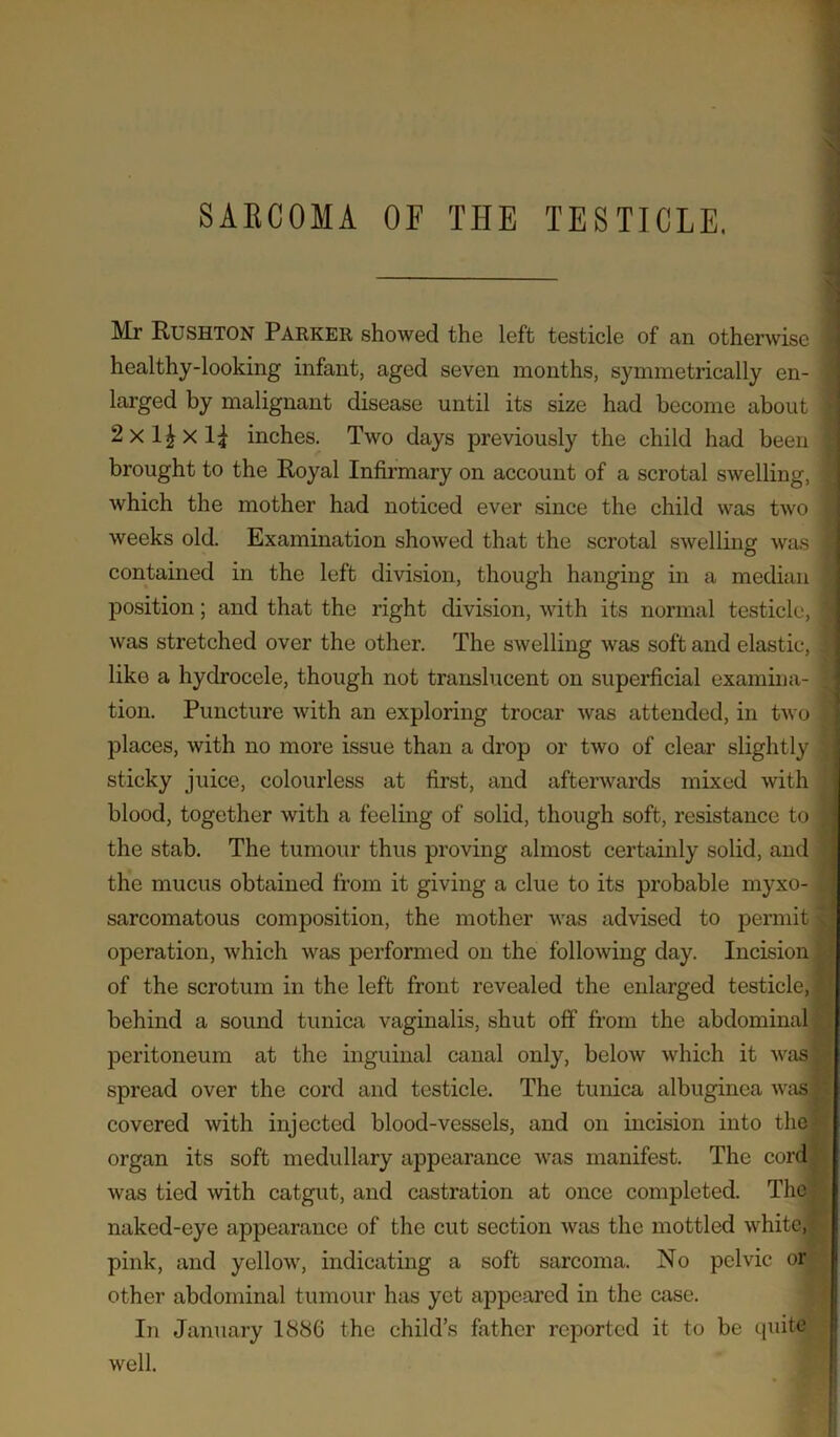 SAECOMA OF THE TESTICLE. Mr Rushton Parker showed the left testicle of an otherwise healthy-looking infant, aged seven months, symmetrically en- larged by malignant disease until its size had become about 2xl|xl| inches. Two days previously the child had been brought to the Royal Infirmary on account of a scrotal swelling, which the mother had noticed ever since the child was two weeks old. Examination showed that the scrotal swelling was contained in the left division, though hanging in a median position; and that the right division, with its normal testicle, was stretched over the other. The swelling was soft and elastic, like a hydrocele, though not translucent on superficial examina- tion. Puncture with an exploring trocar was attended, in two places, with no more issue than a drop or two of clear slightly sticky juice, colourless at first, and afterwards mixed with blood, together with a feeling of solid, though soft, resistance to the stab. The tumour thus proving almost certainly solid, and the mucus obtained from it giving a clue to its probable myxo- sarcomatous composition, the mother was advised to permit operation, which was performed on the following day. Incision of the scrotum in the left front revealed the enlarged testicle, behind a sound tunica vaginalis, shut off from the abdominal peritoneum at the inguinal canal only, below which it was spread over the cord and testicle. The tunica albuginea was covered with injected blood-vessels, and on incision into the organ its soft medullary appearance was manifest. The cord was tied with catgut, and castration at once completed. The naked-eye appearance of the cut section was the mottled white, pink, and yellow, indicating a soft sarcoma. No pelvic or other abdominal tumour has yet appeared in the case. In January 1886 the child’s father reported it to be quite well. . 1
