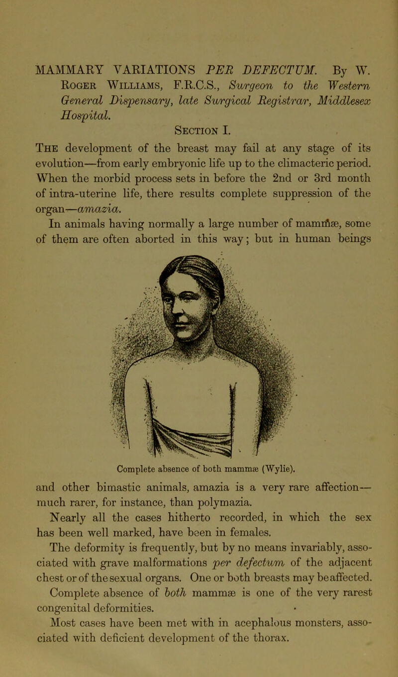 MAMMARY VARIATIONS PER DEFECTUM. By W. Roger Williams, F.R.C.S., Surgeon to the Western General Dispensary, late Surgical Registrar, Middlesex Hospital. Section I. The development of the breast may fail at any stage of its evolution—from early embryonic life up to the climacteric period. When the morbid process sets in before the 2nd or 3rd month of intra-uterine life, there results complete suppression of the organ—amazia. In animals having normally a large number of mamiflae, some of them are often aborted in this way; but in human beings Complete absence of both mammae (Wylie), and other bimastic animals, amazia is a very rare affection— much rarer, for instance, than polymazia. Nearly all the cases hitherto recorded, in which the sex has been well marked, have been in females. The deformity is frequently, but by no means invariably, asso- ciated with grave malformations per defectum of the adjacent chest or of the sexual organs. One or both breasts may be affected. Complete absence of both mammae is one of the very rarest congenital deformities. Most cases have been met with in acephalous monsters, asso- ciated with deficient development of the thorax.