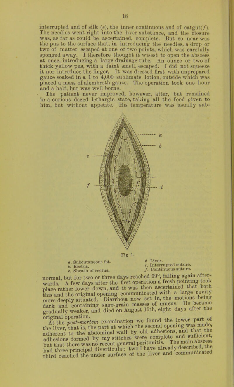 interrupted and of silk (e), the inner continuous and of catgut(/). The needles went right into the liver substance, and the closure was, as far as could be ascertained, complete. But so near was the pus to the surface that, in introducing the needles, a drop or two of matter escaped at one or two points, which was carefully sponged away. I therefore thought it wisest to open the abscess at once, introducing a large drainage tube. An ounce or two of thick yellow pus, with a faint smell, escaped. I did not squeeze it nor introduce the finger, It was dressed first with unprepared gauze soaked in a 1 to 4,000 sublimate lotion, outside which was placed a mass of alembroth gauze. The operation took one hour and a half, but was well borne. The patient never improved, however, after, but remained in a curious dazed lethargic state, taking all the food given to him, but without appetite. His temperature was usually sub- Fig. l. «. Subcutaneous tat. h. Rectus. c. Sheath of rectus. «f. Liver. e. Interrupted suture. /• Continuous suture. normal, but for two or three days reached 99°, falling again after- wards. A few days after the first operation a fresh pointing took place rather lower down, and it was then ascertained that both this and the original opening communicated with a large cavity more deeply situated. Diarrhoea now set in, the motions being dark and containing sago-gram masses of mucus. He became gradually weaker, and died on August 15th, eight days after the °rk’t°he post-mortem examination we found the lower Part of the liver that is, the part at which the second opening was made, adherent to the’ abdominal wall by old lesions and that t^ adhesions formed by my stitches were compete and ancient but that there was no recent general peritonitis. The.mainat.scess had three principal diverticula; two I have already described, tl e thHd reacEed Z under surface of the liver and communicated