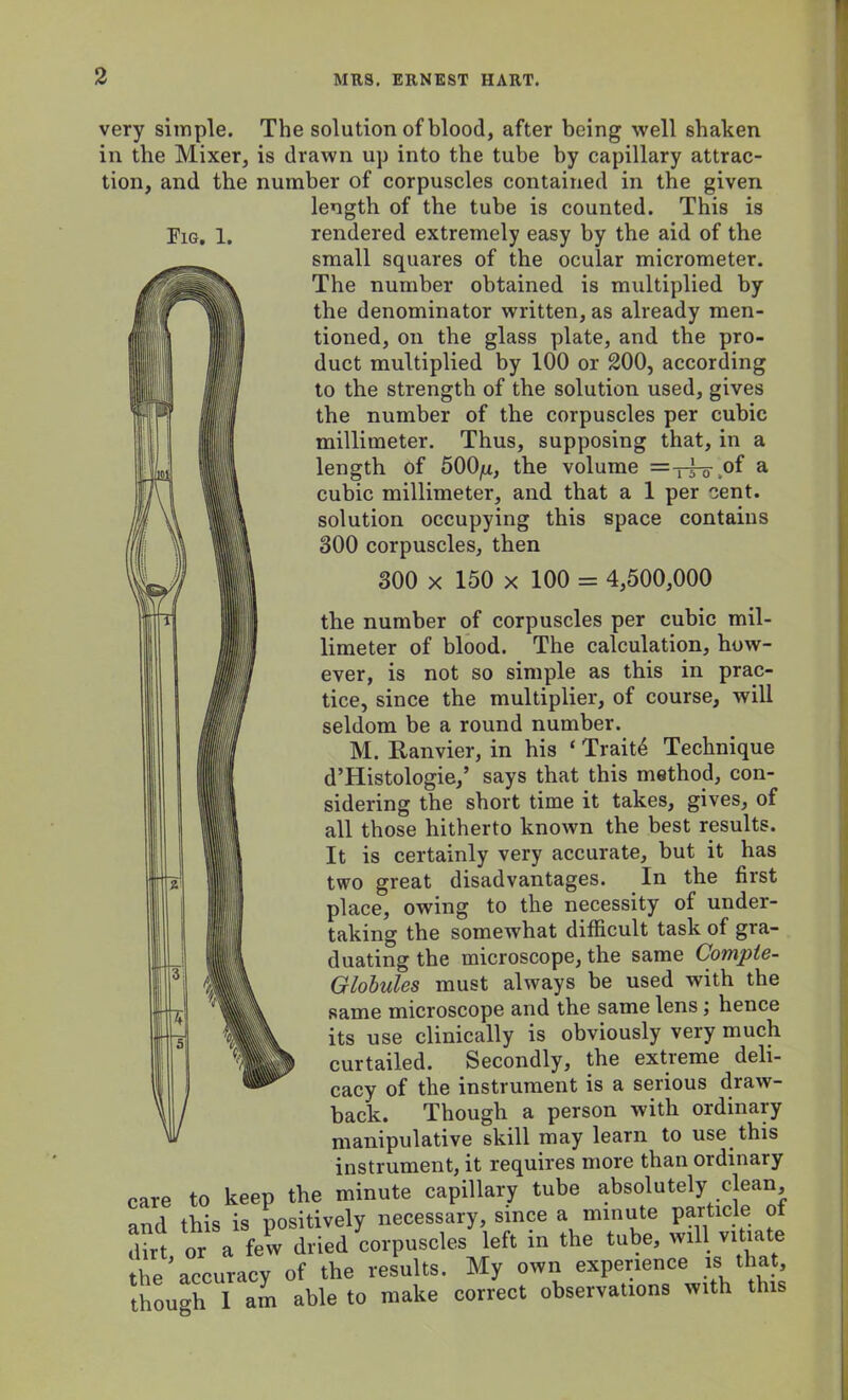 very simple. The solution of blood, after being well shaken in the Mixer, is drawn up into the tube by capillary attrac- tion, and the number of corpuscles contained in the given length of the tube is counted. This is Pig, 1, rendered extremely easy by the aid of the small squares of the ocular micrometer. The number obtained is multiplied by the denominator written, as already men- tioned, on the glass plate, and the pro- duct multiplied by 100 or 200, according to the strength of the solution used, gives the number of the corpuscles per cubic millimeter. Thus, supposing that, in a length of 500ju, the volume =-r3-o\°f a cubic millimeter, and that a 1 per cent, solution occupying this space contains 300 corpuscles, then 300 x 150 x 100 = 4,500,000 the number of corpuscles per cubic mil- limeter of blood. The calculation, how- ever, is not so simple as this in prac- tice, since the multiplier, of course, will seldom be a round number. M. Ranvier, in his ‘ Trait4 Technique d’Histologie,’ says that this method, con- sidering the short time it takes, gives, of all those hitherto known the best results. It is certainly very accurate, but it has two great disadvantages. In the first place, owing to the necessity of under- taking the somewhat difficult task of gra- duating the microscope, the same Comple- Globules must always be used with the same microscope and the same lens; hence its use clinically is obviously very much curtailed. Secondly, the extreme deli- cacy of the instrument is a serious draw- back. Though a person with ordinary manipulative skill may learn to use this instrument, it requires more than ordinary care to keep the minute capillary tube absolutely clean, and this is positively necessary, since a minute particle of S?tt or a few dried corpuscles left in the tube, will vitiate the ’ accuracy of the results. My own experience is that, though 1 am able to make correct observations with this