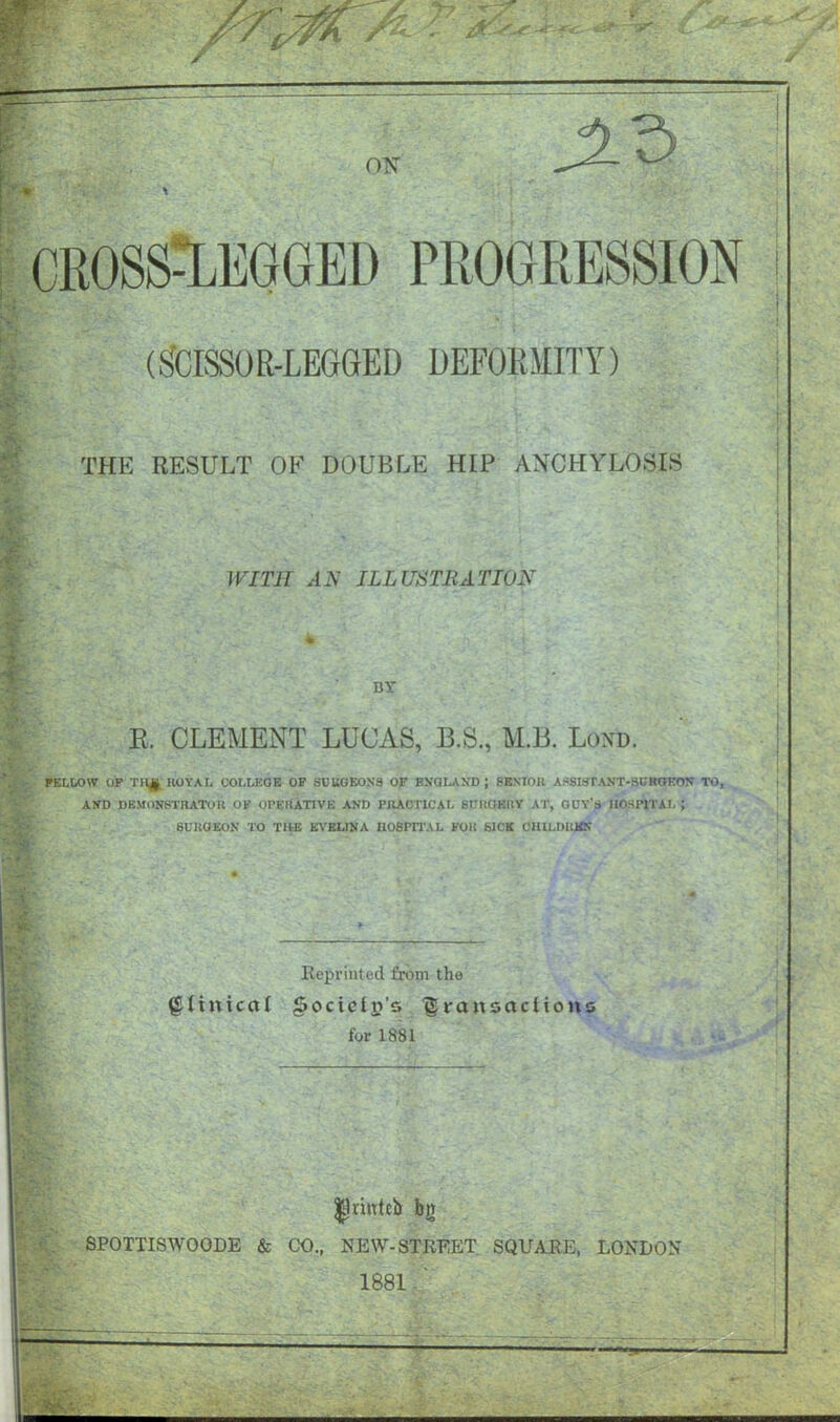 CROSS-LEGGED PROGRESSION (gCISSOR-LEGGED DEFORMITY) THE RESULT OF DOUBLE HIP ANCHYLOSIS i'. WITH AN ILLUSTRATION BY R. CLEMENT LUCAS, B.S., M.B. Lorn FELLOW OF TH£ HOYAL COLLEGE OF SUUGEONS OF ENGLAND ; SENIOR ASSISTANT-SB*OEOTT TO, AND DEMONSTRATOR OF orEUATIVE AND PRACTICAL 6CI1C.EHY AT, GDY’S HOSPITAL ; X' 6UHGEON TO THE EVELINA HOSPITAL FOH SICK CHLLDUKN Reprinted from the Clinical §octcit?'s ^ransacUoits for 1881 flprmteb bg SPOTTISWOODE & CO., NEW-STREET SQUARE, LONDON 1881